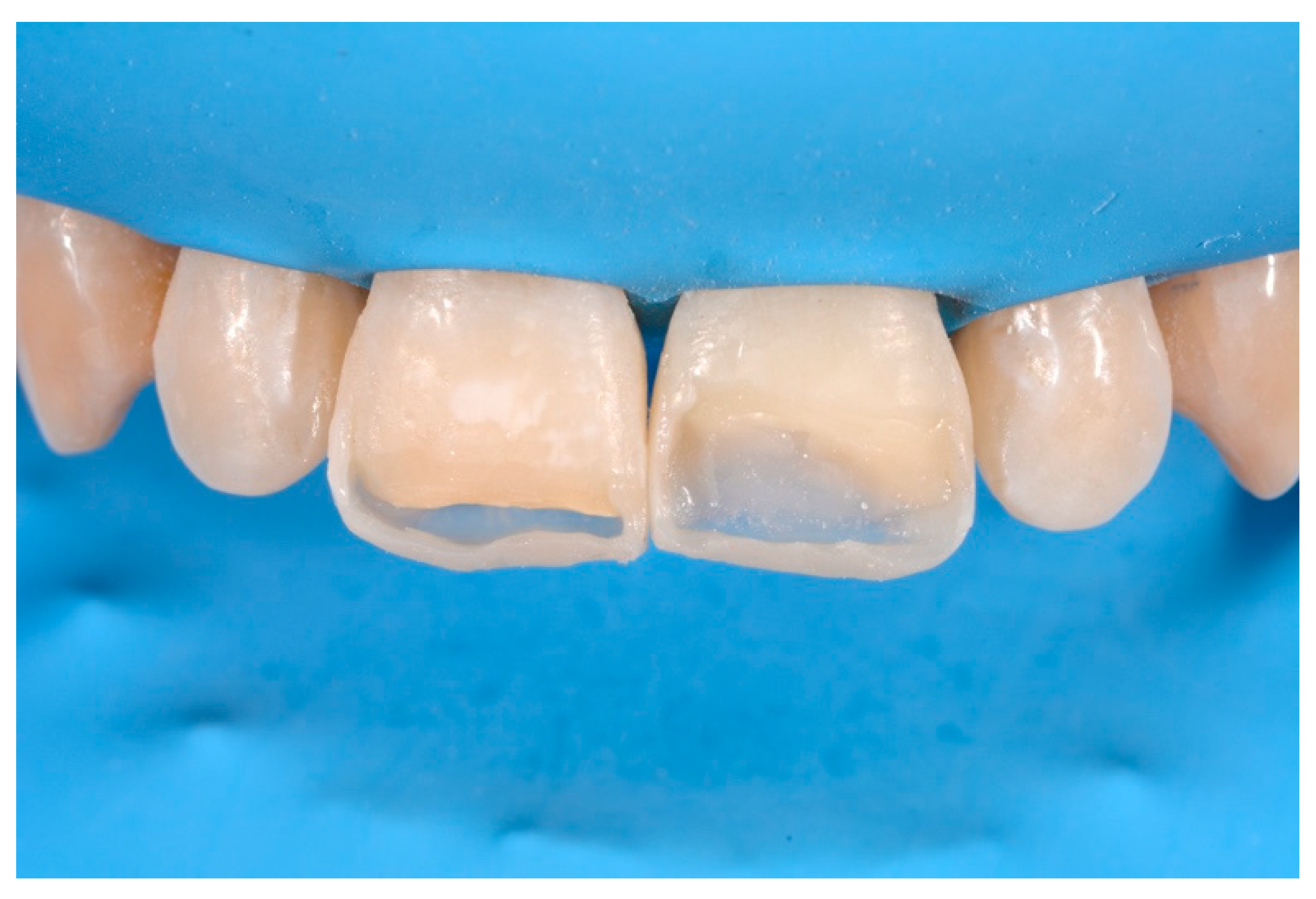 Dentistry 09 00079 g059 550