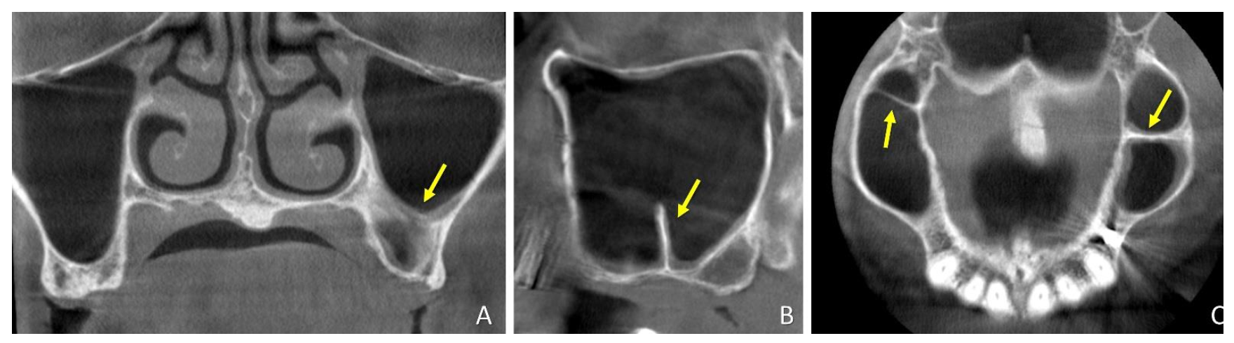 Dentistry 09 00082 g002 550
