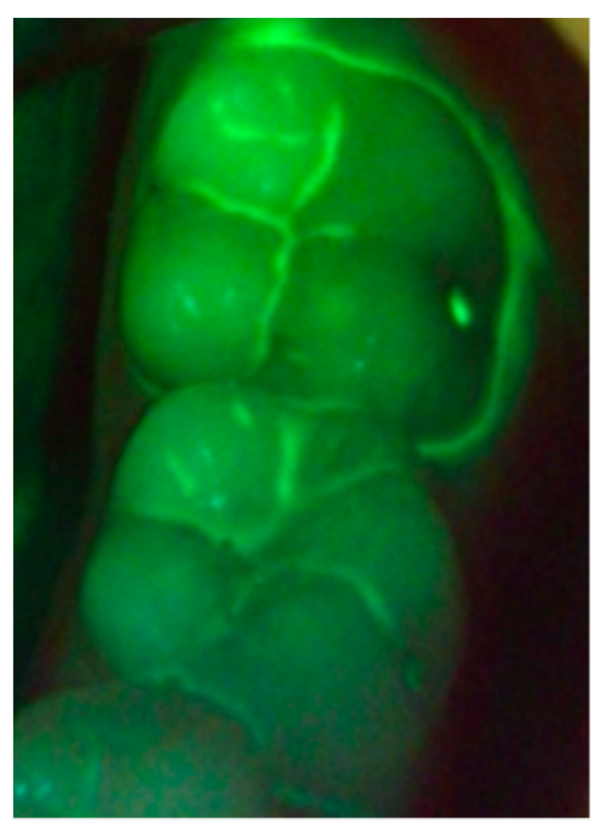 Dentistry 09 00090 g004