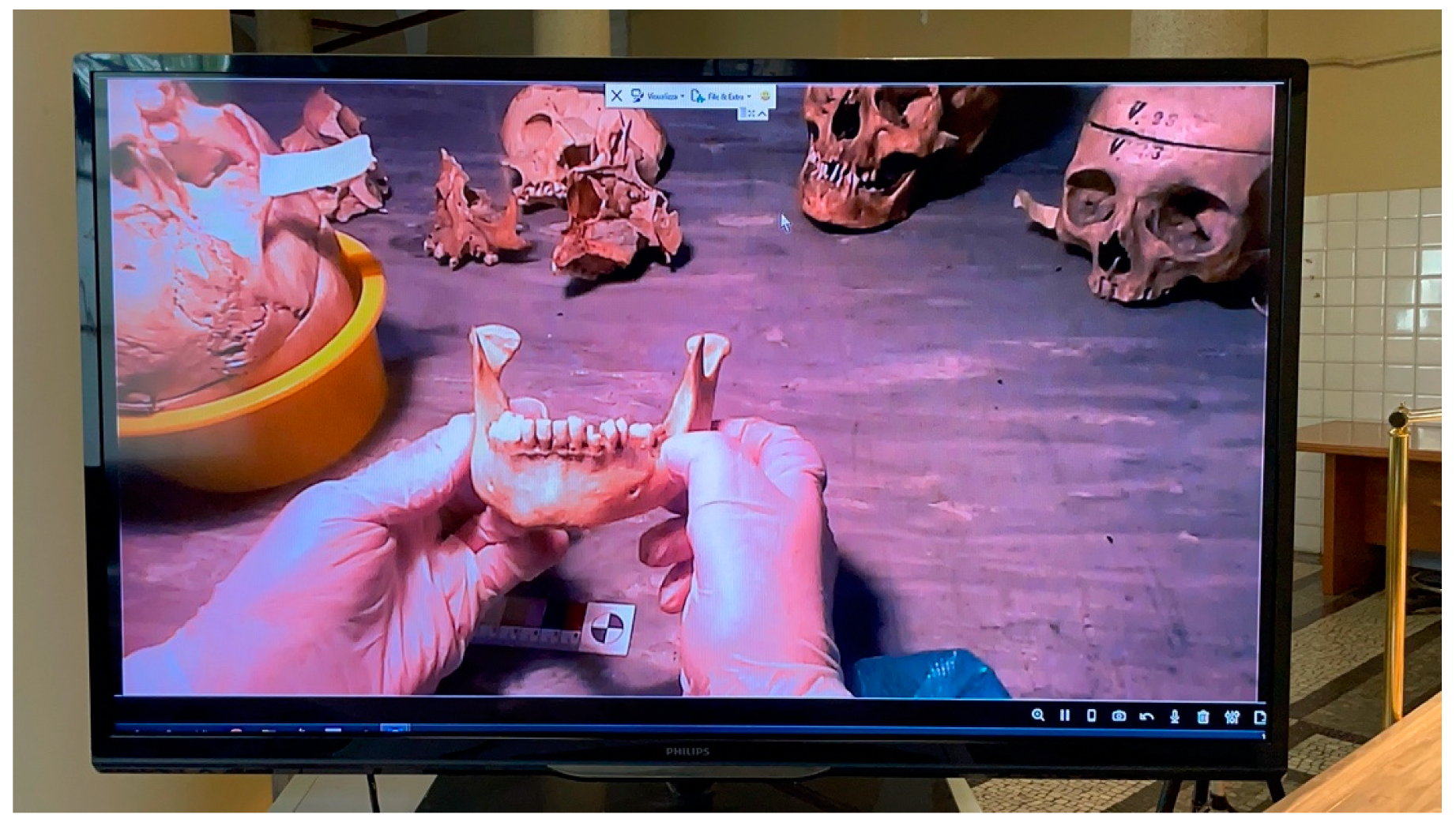 Dentistry 09 00102 g004 Dentistry 09 00102 g004