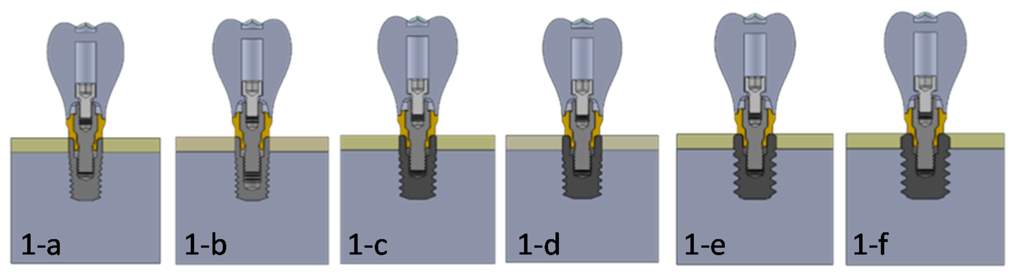 Dentistry 09 00103 g001 Dentistry 09 00103 g001