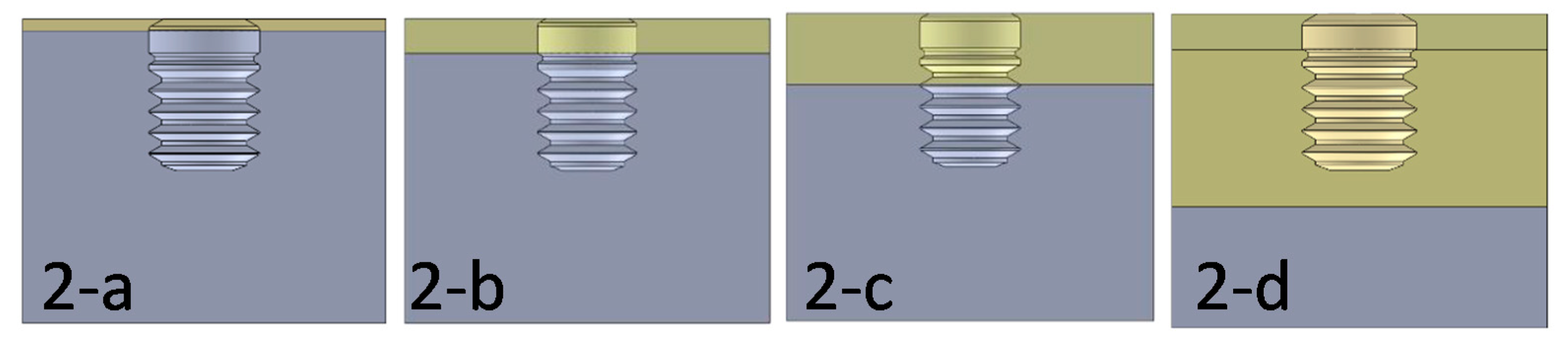 Dentistry 09 00103 g002 Dentistry 09 00103 g002