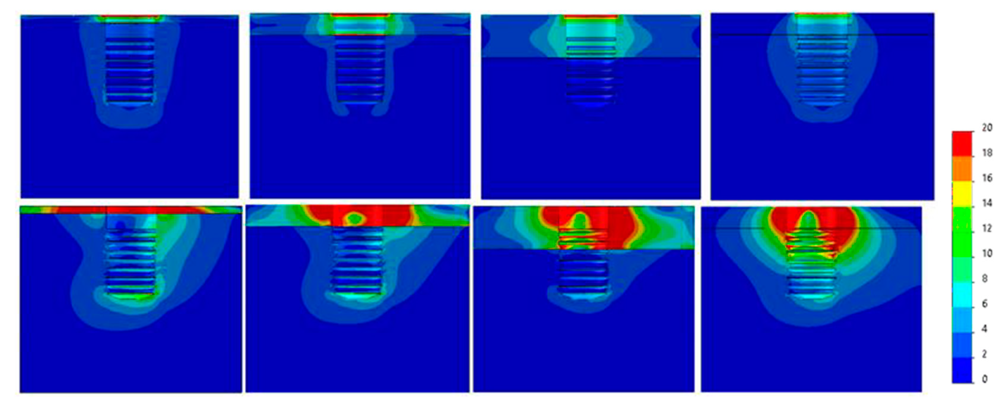 Dentistry 09 00103 g008 Dentistry 09 00103 g008