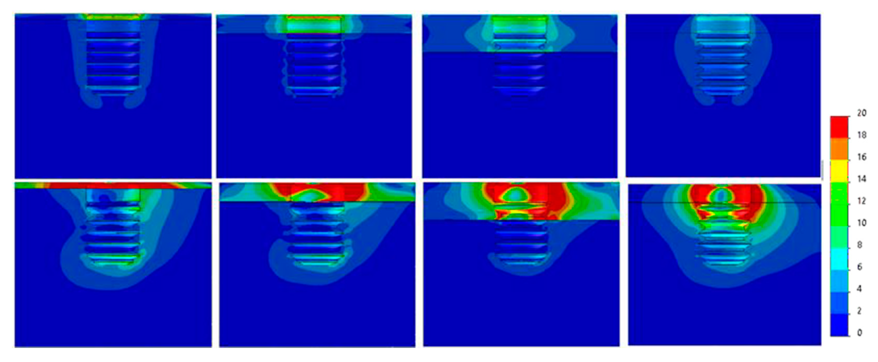Dentistry 09 00103 g011 Dentistry 09 00103 g011