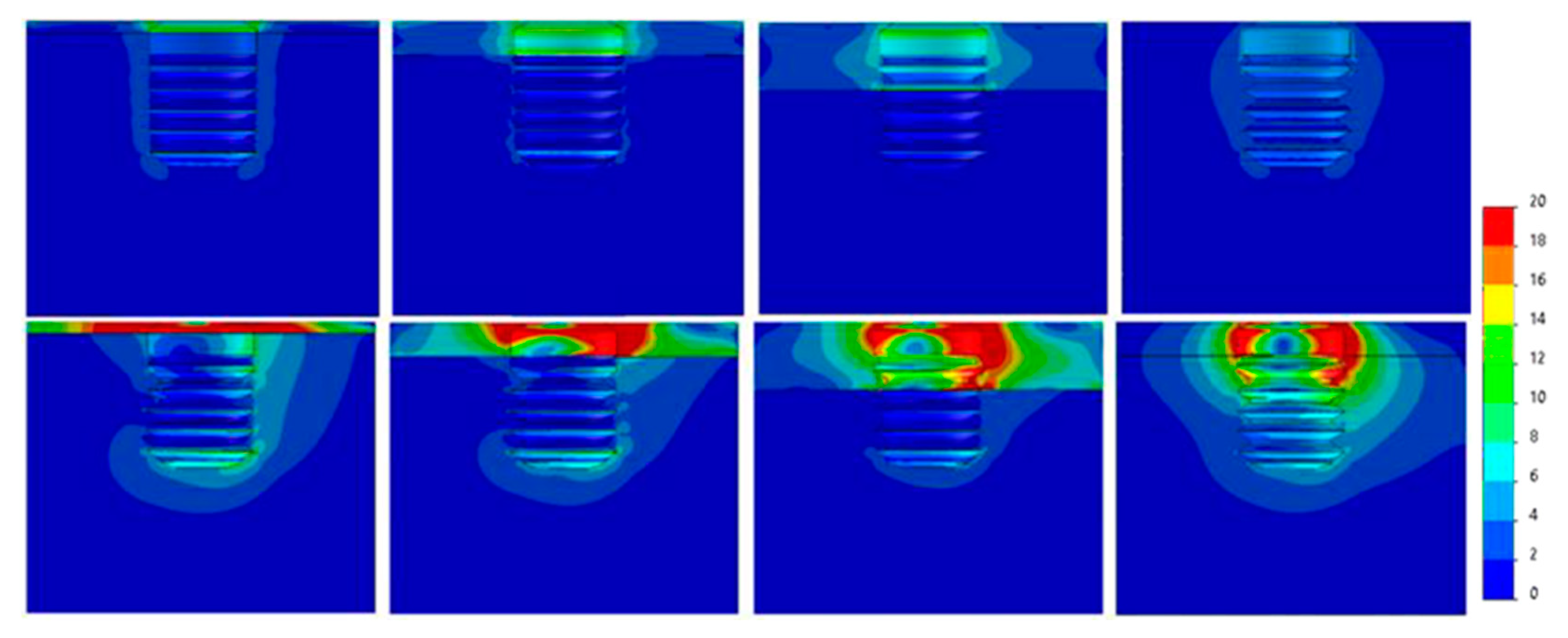 Dentistry 09 00103 g012 Dentistry 09 00103 g012