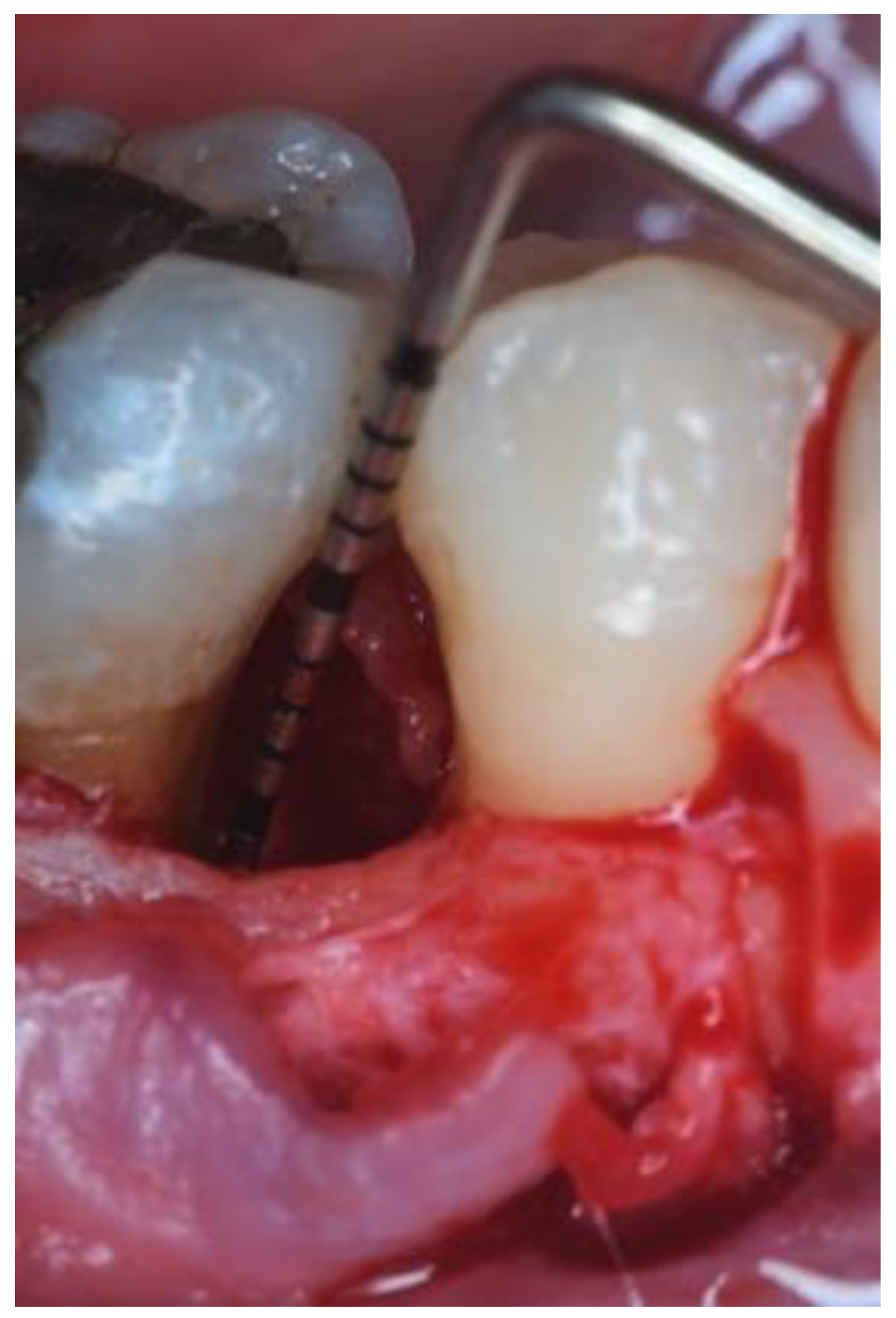 Dentistry 09 00110 g002