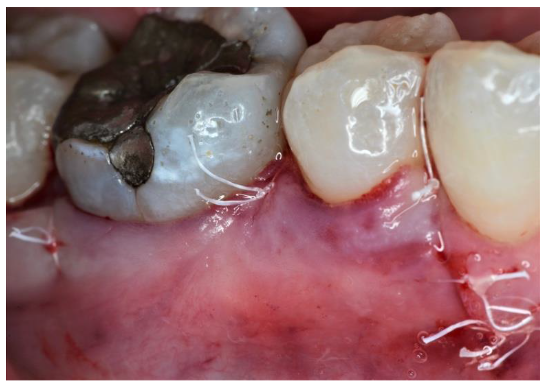 Dentistry 09 00110 g004