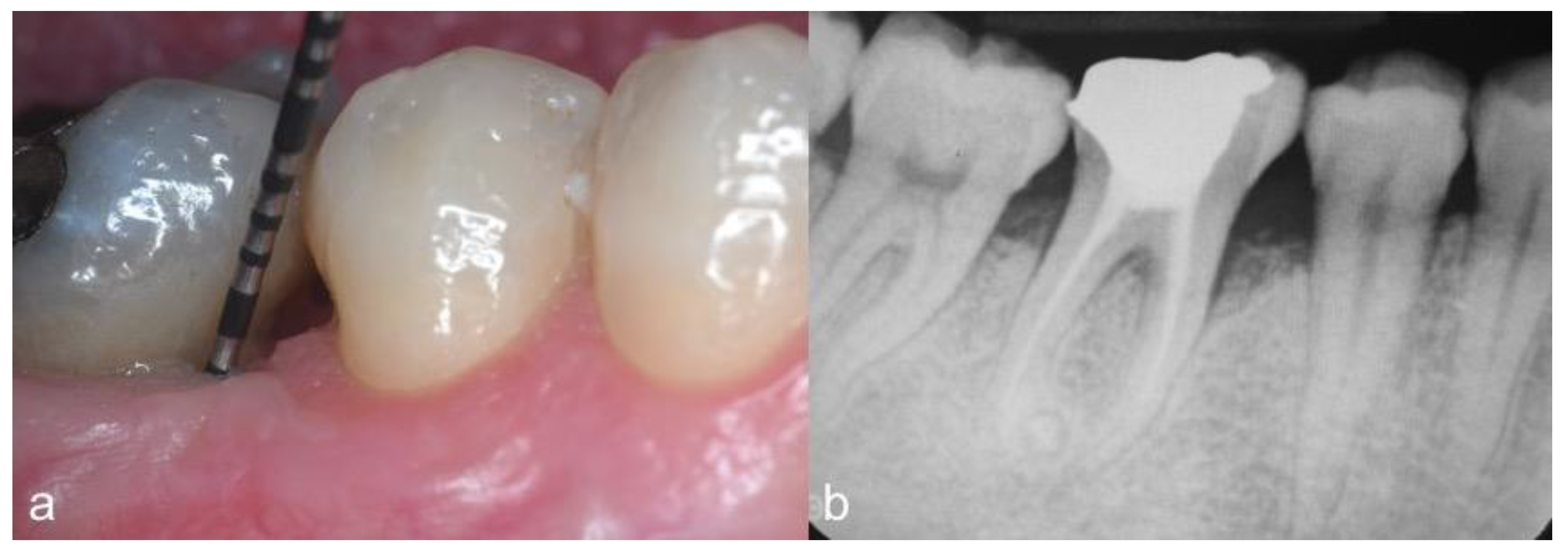 Dentistry 09 00110 g005