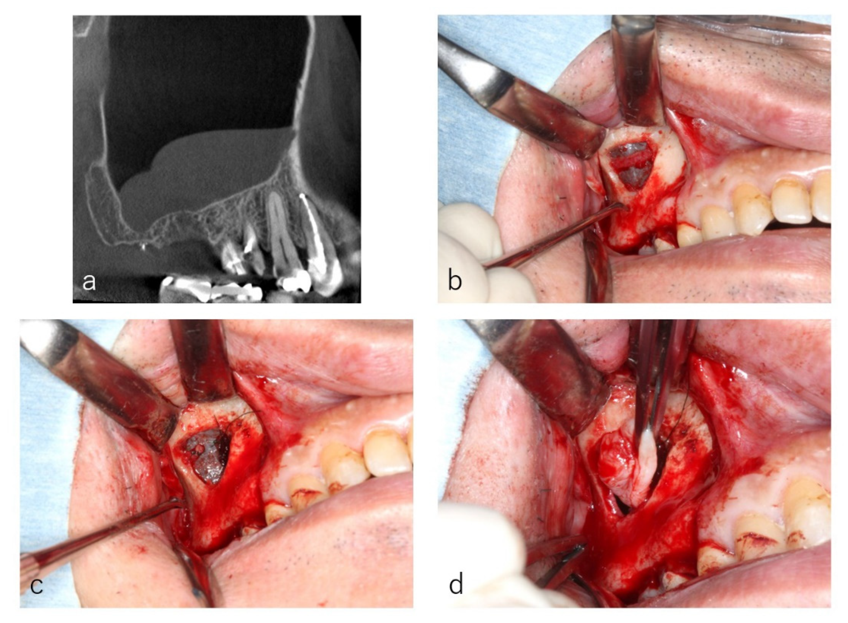Dentistry 09 00122 g004 550