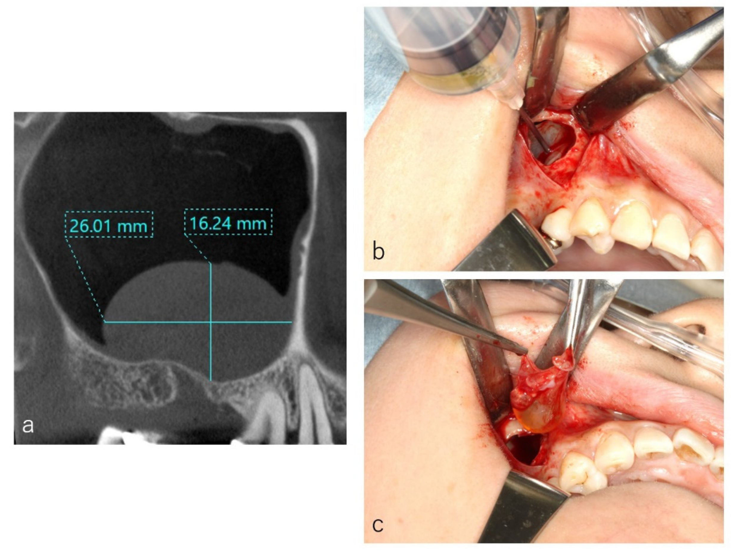 Dentistry 09 00122 g005 550
