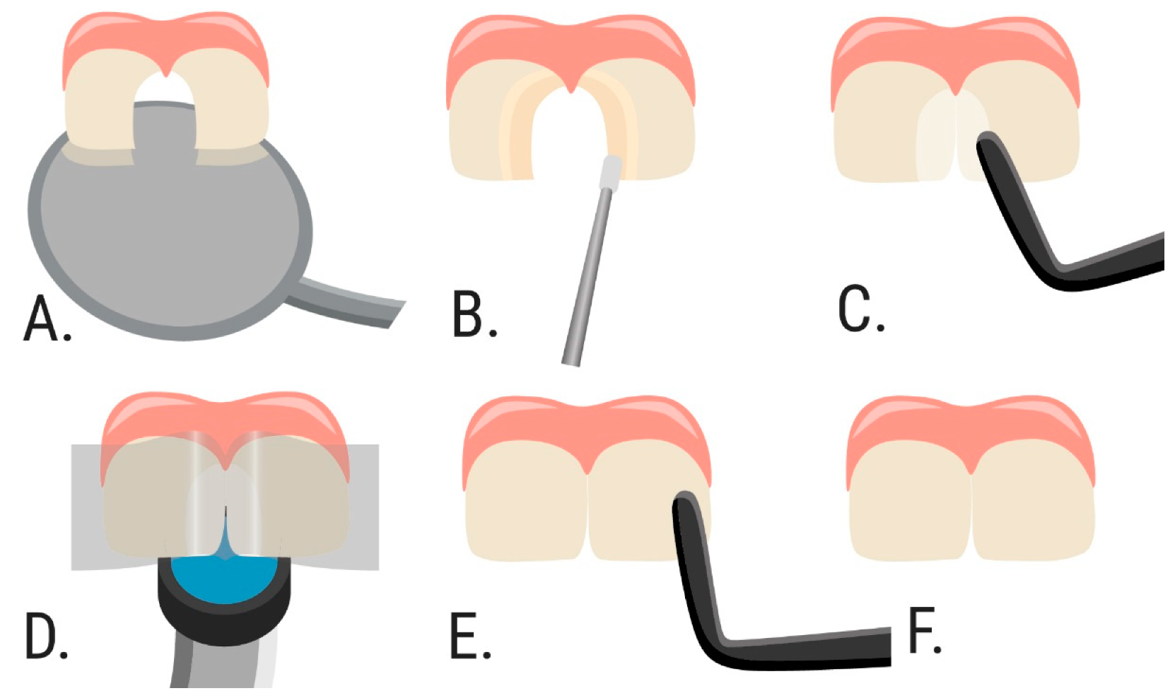 Dentistry 09 00126 g002 550