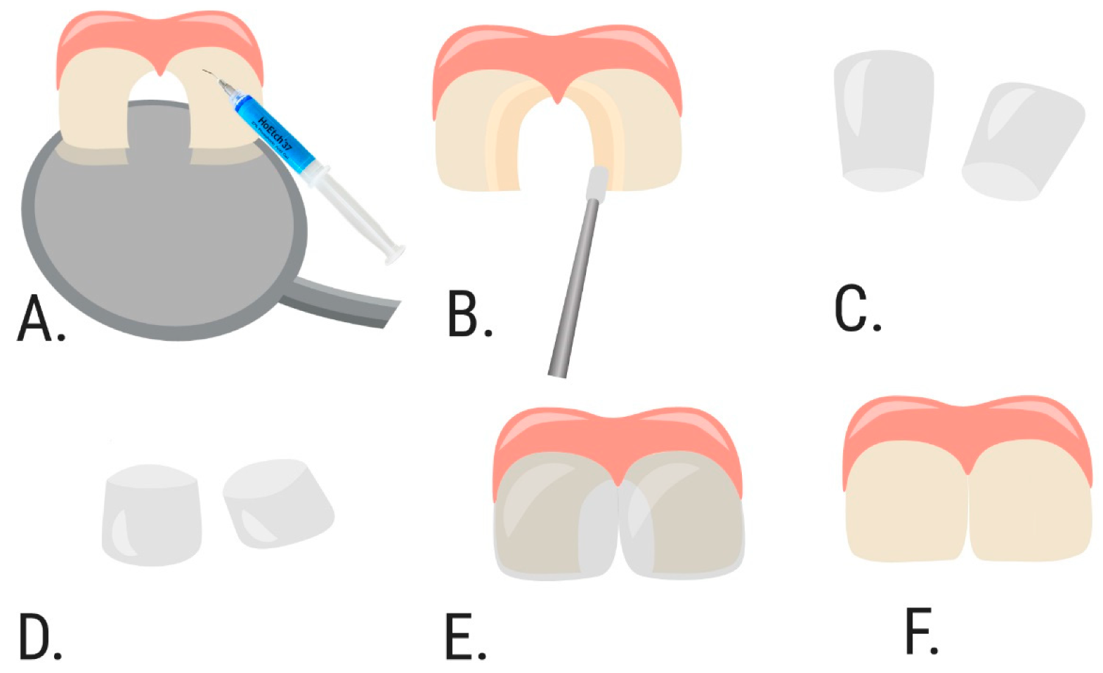 Dentistry 09 00126 g003 550