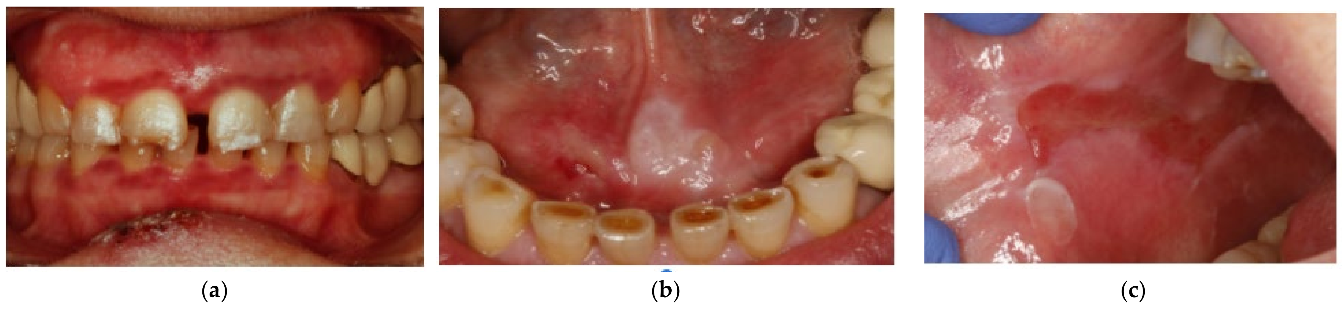 Dentistry 09 00137 g001 550
