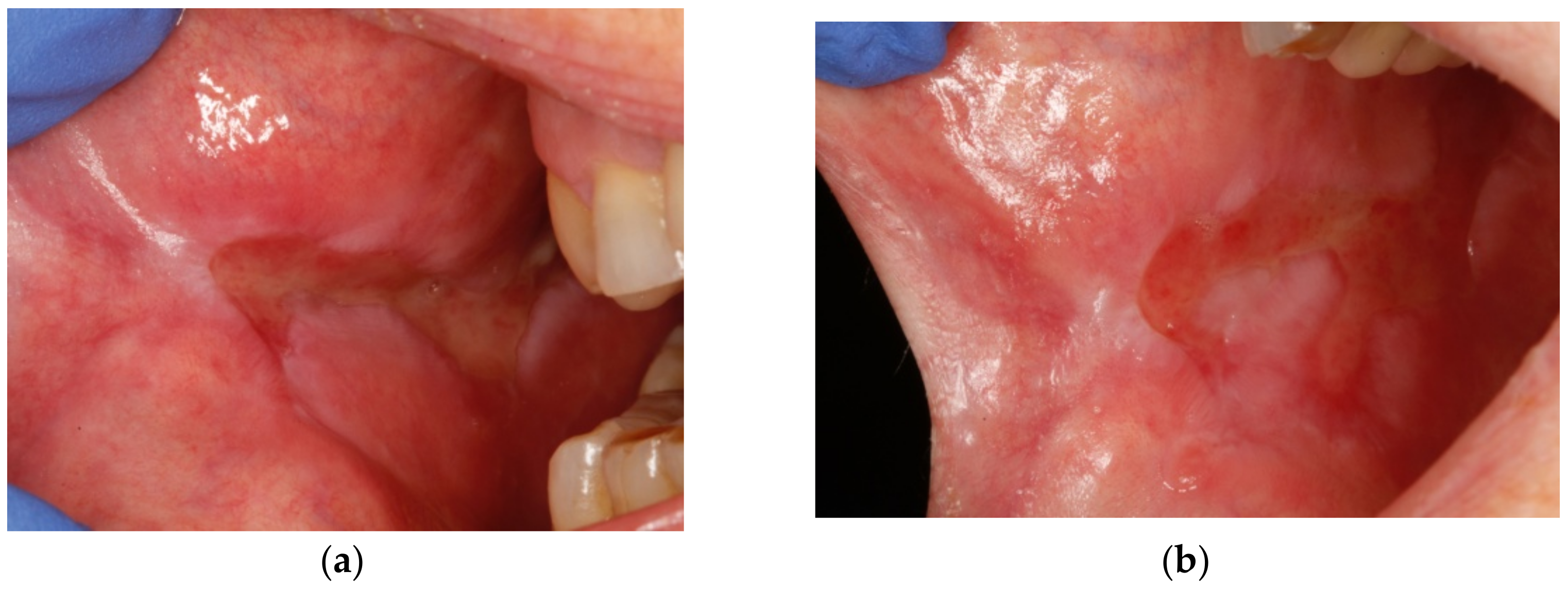 Dentistry 09 00137 g003a 550