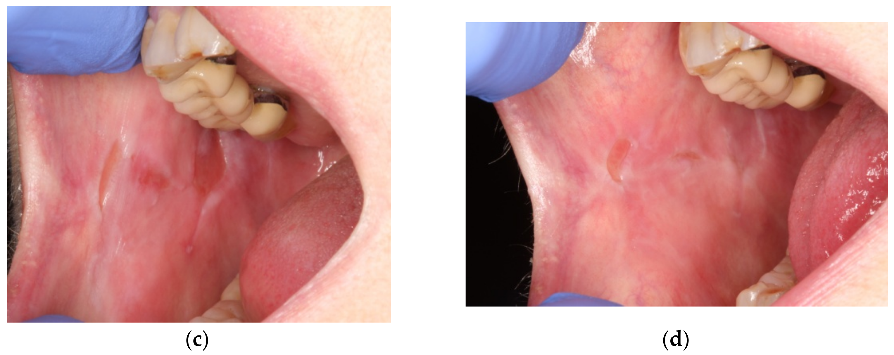 Dentistry 09 00137 g003b 550