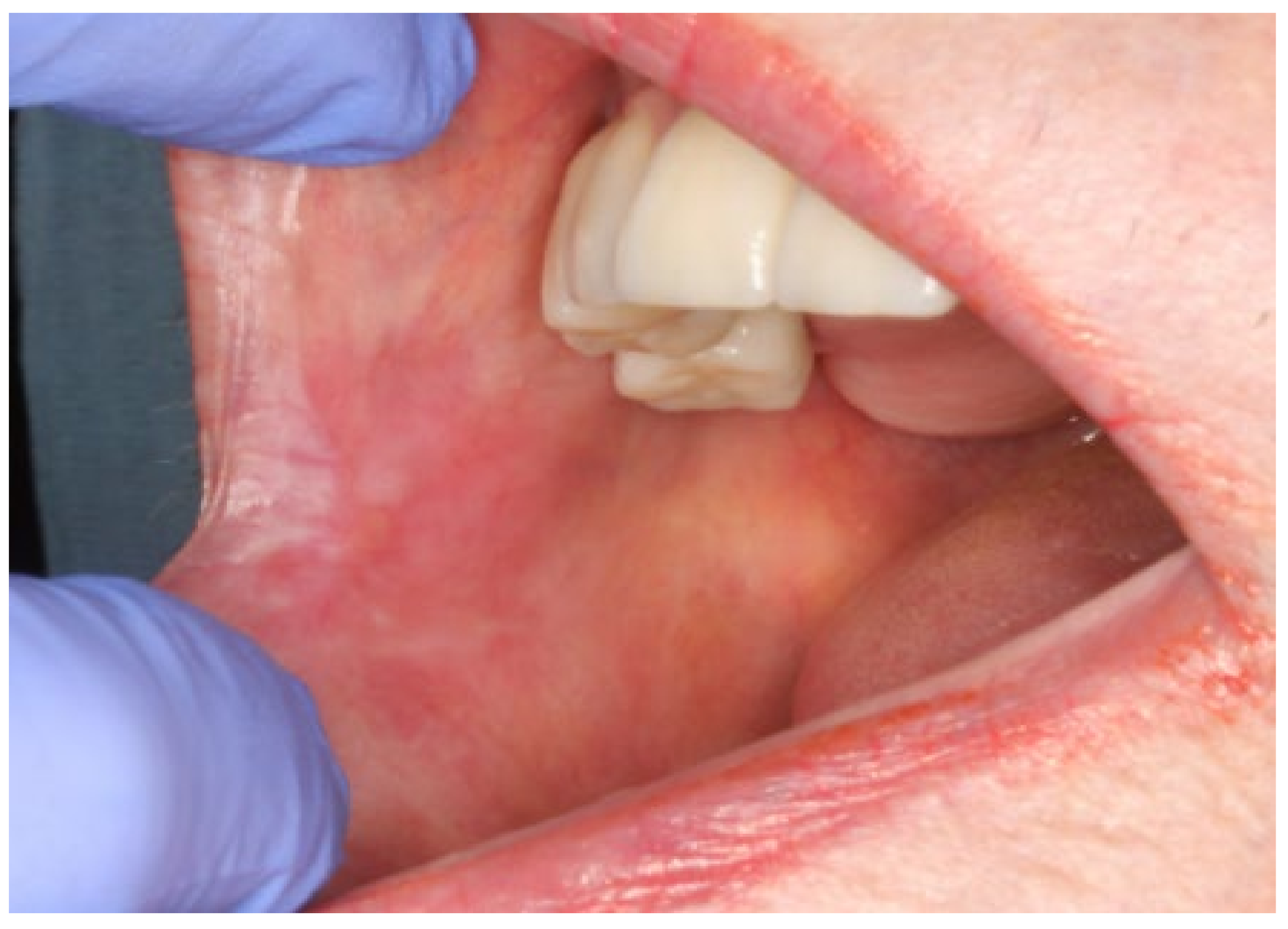 Dentistry 09 00137 g004 550