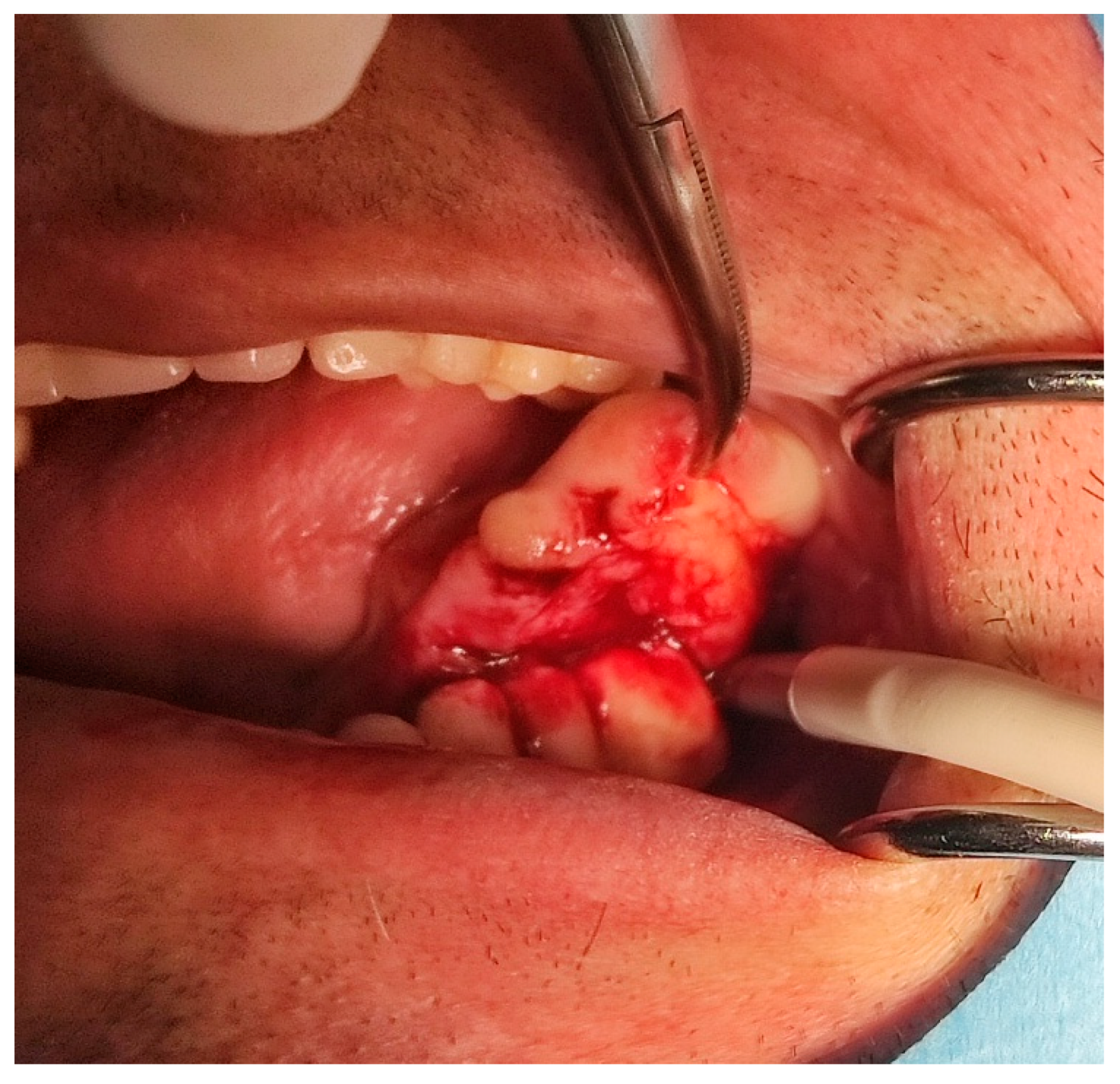 Dentistry 10 00009 g003