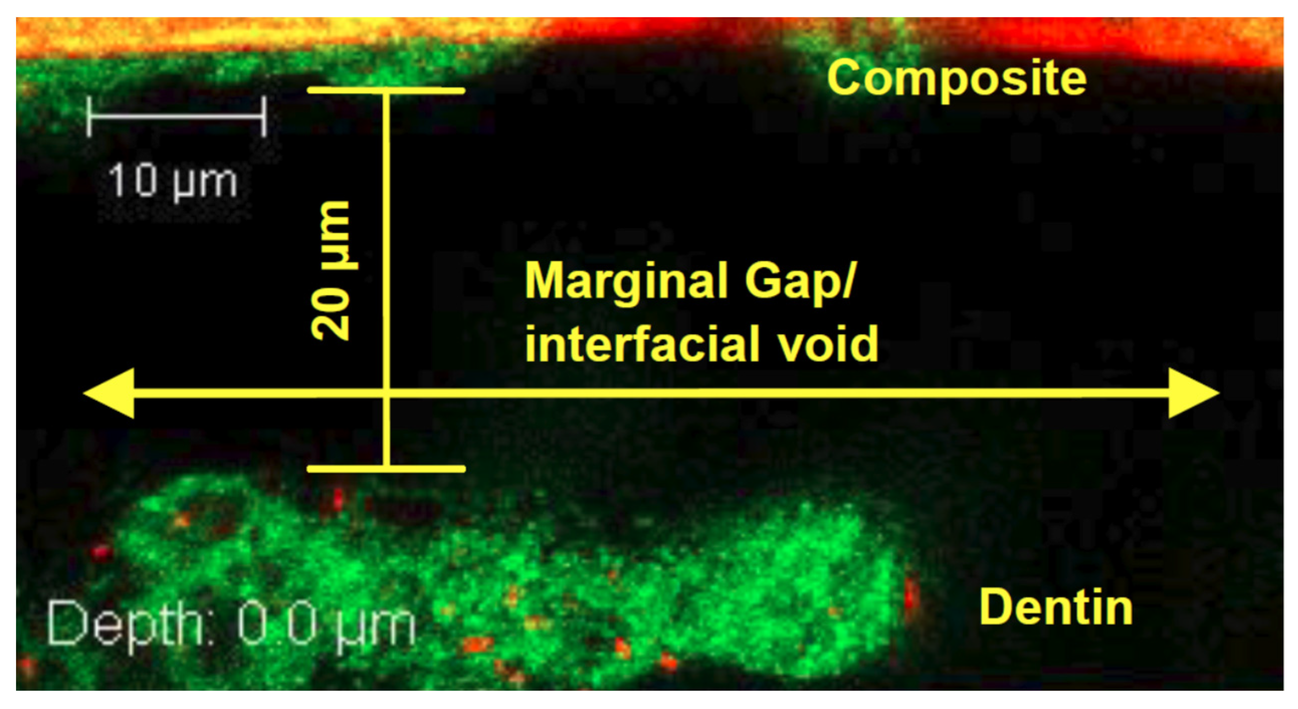 Dentistry 10 00013 g005 Dentistry 10 00013 g005