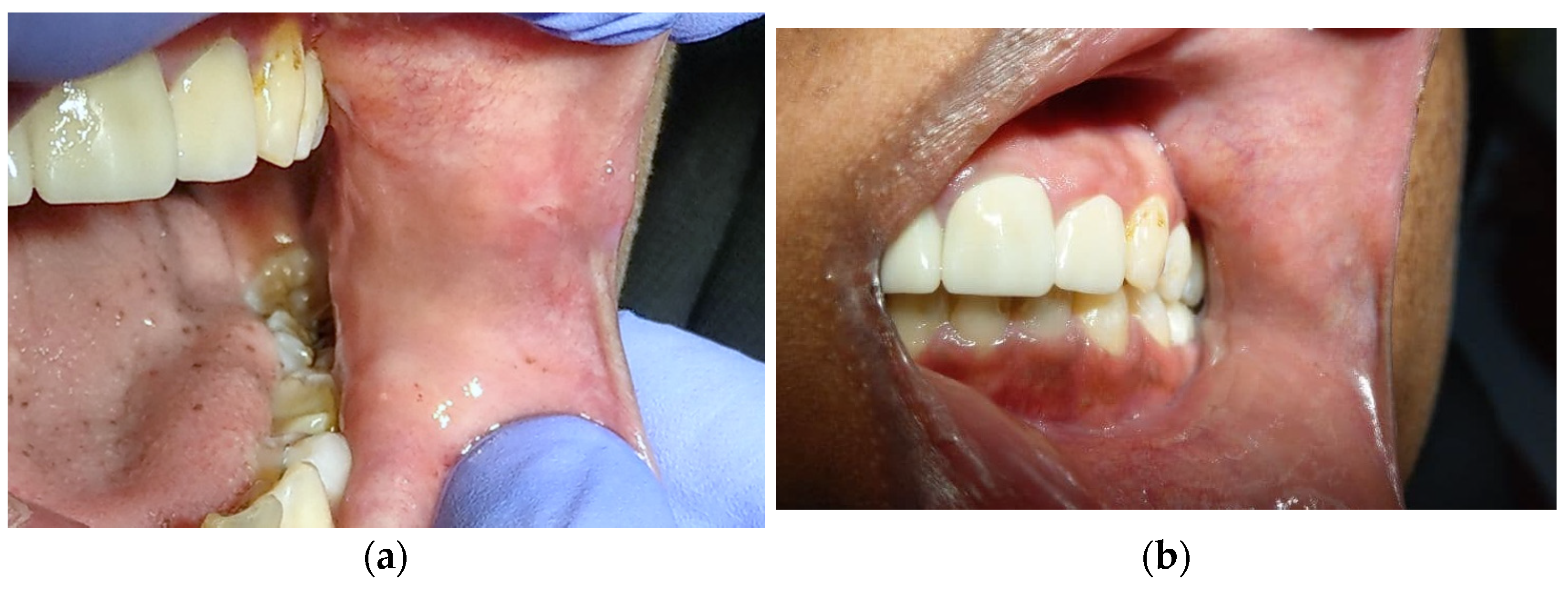 Dentistry 10 00017 g004