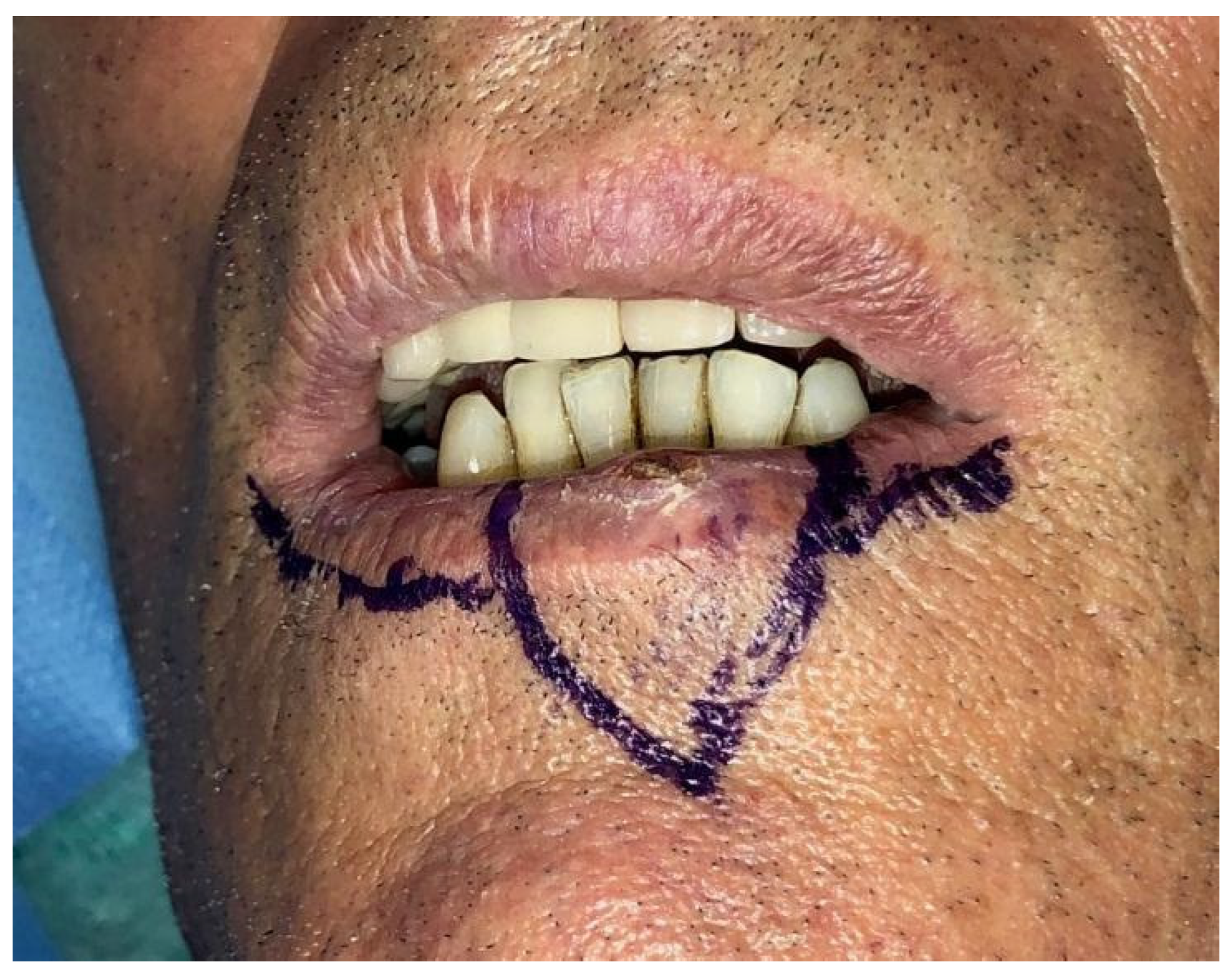 Dentistry 10 00019 g001 550