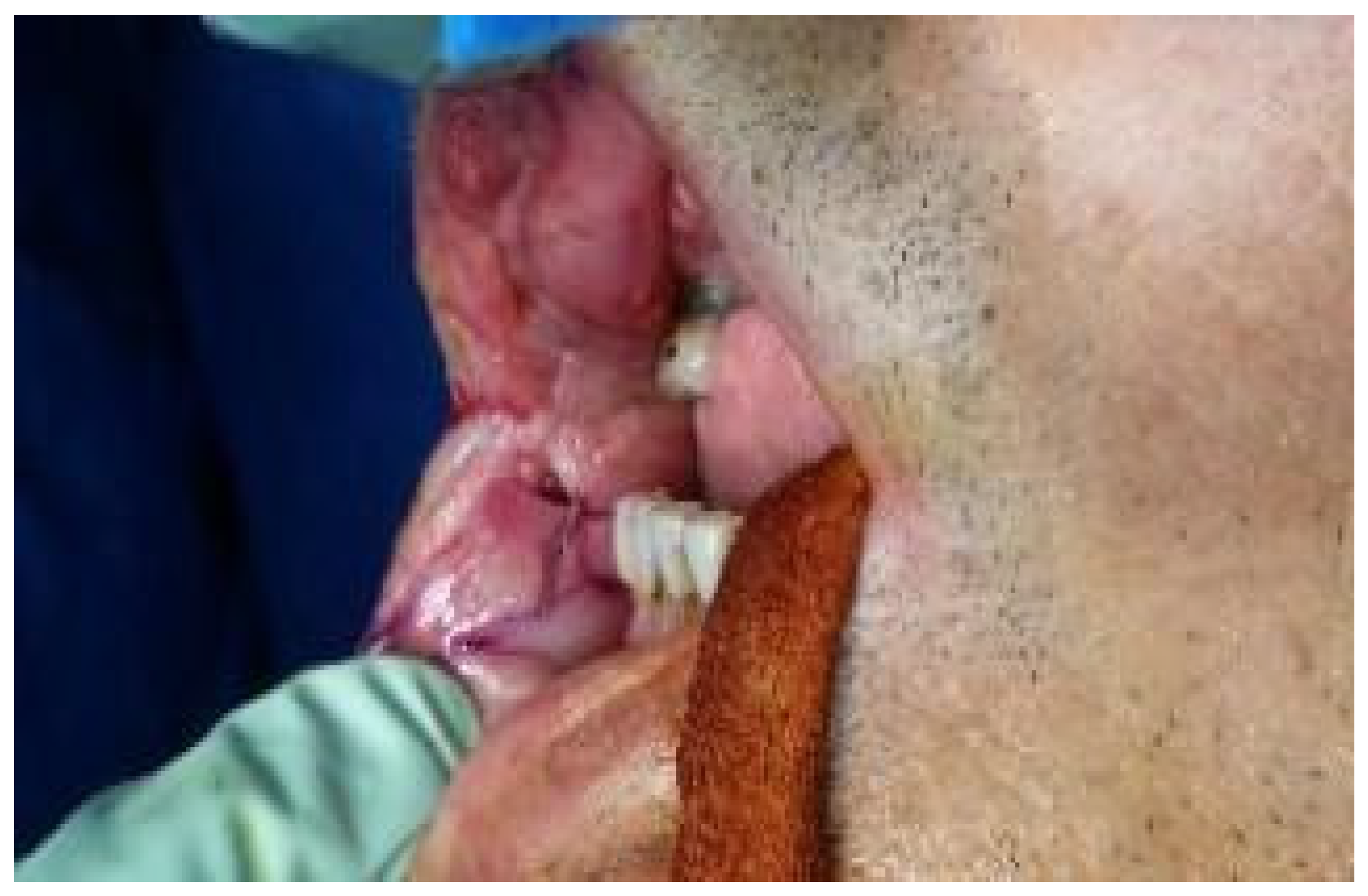 Dentistry 10 00019 g005 550