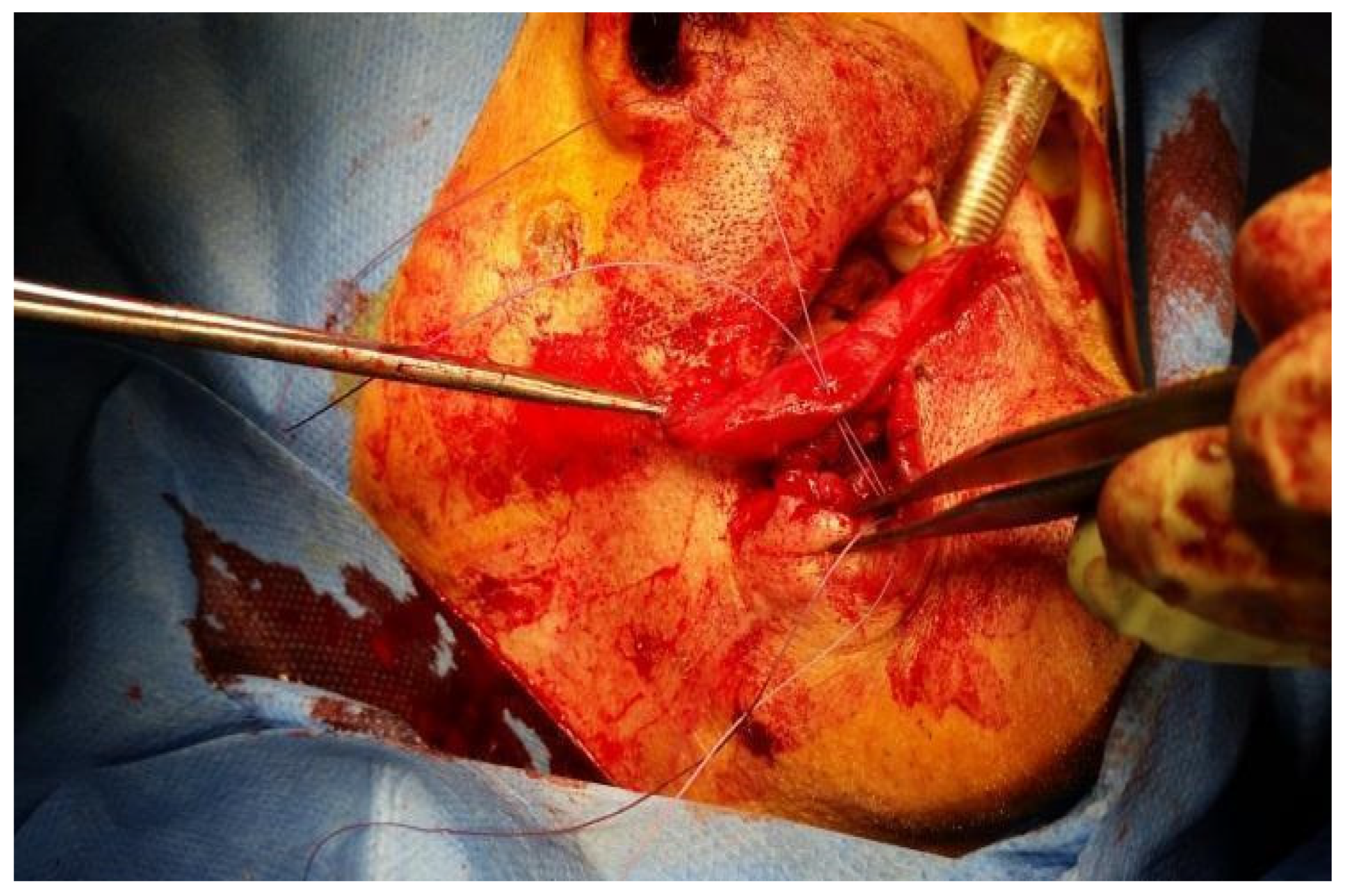 Dentistry 10 00019 g008 550