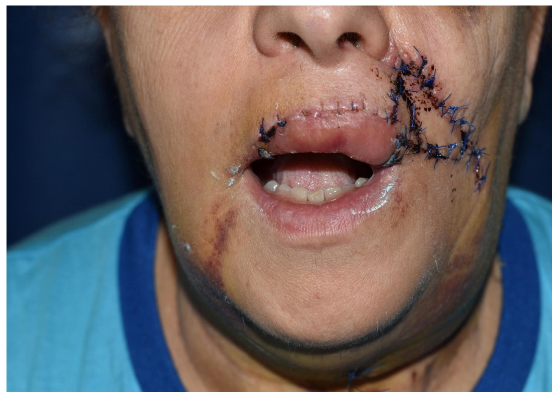 Dentistry 10 00019 g013 550