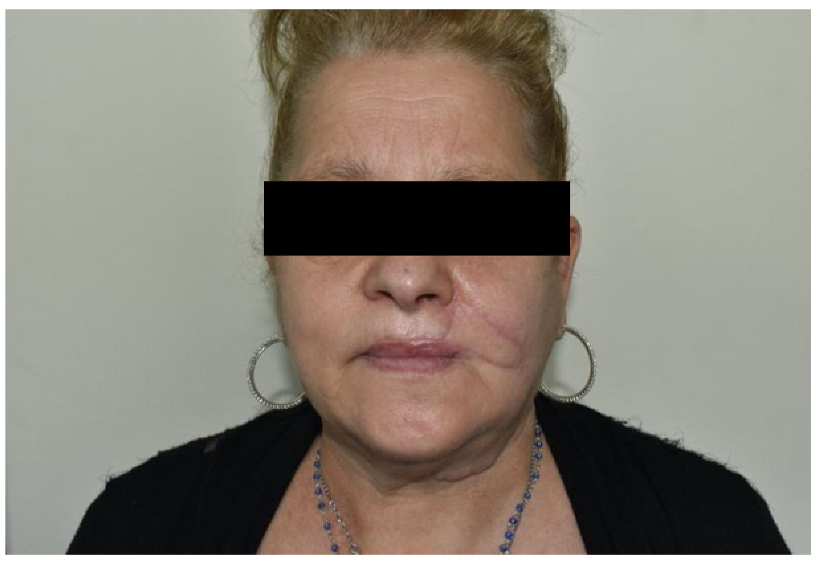 Dentistry 10 00019 g015 550