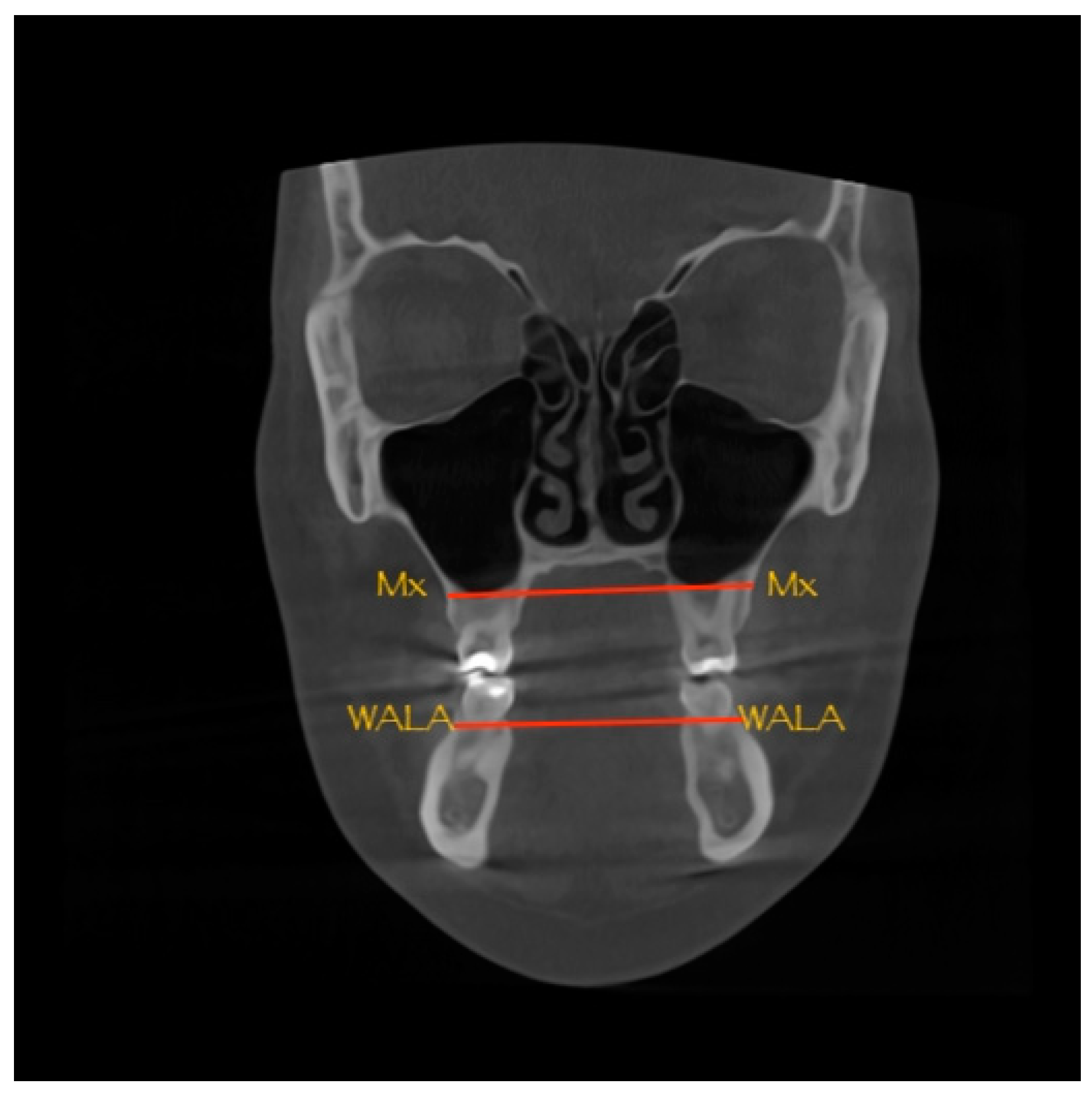 Dentistry 10 00023 g002 550