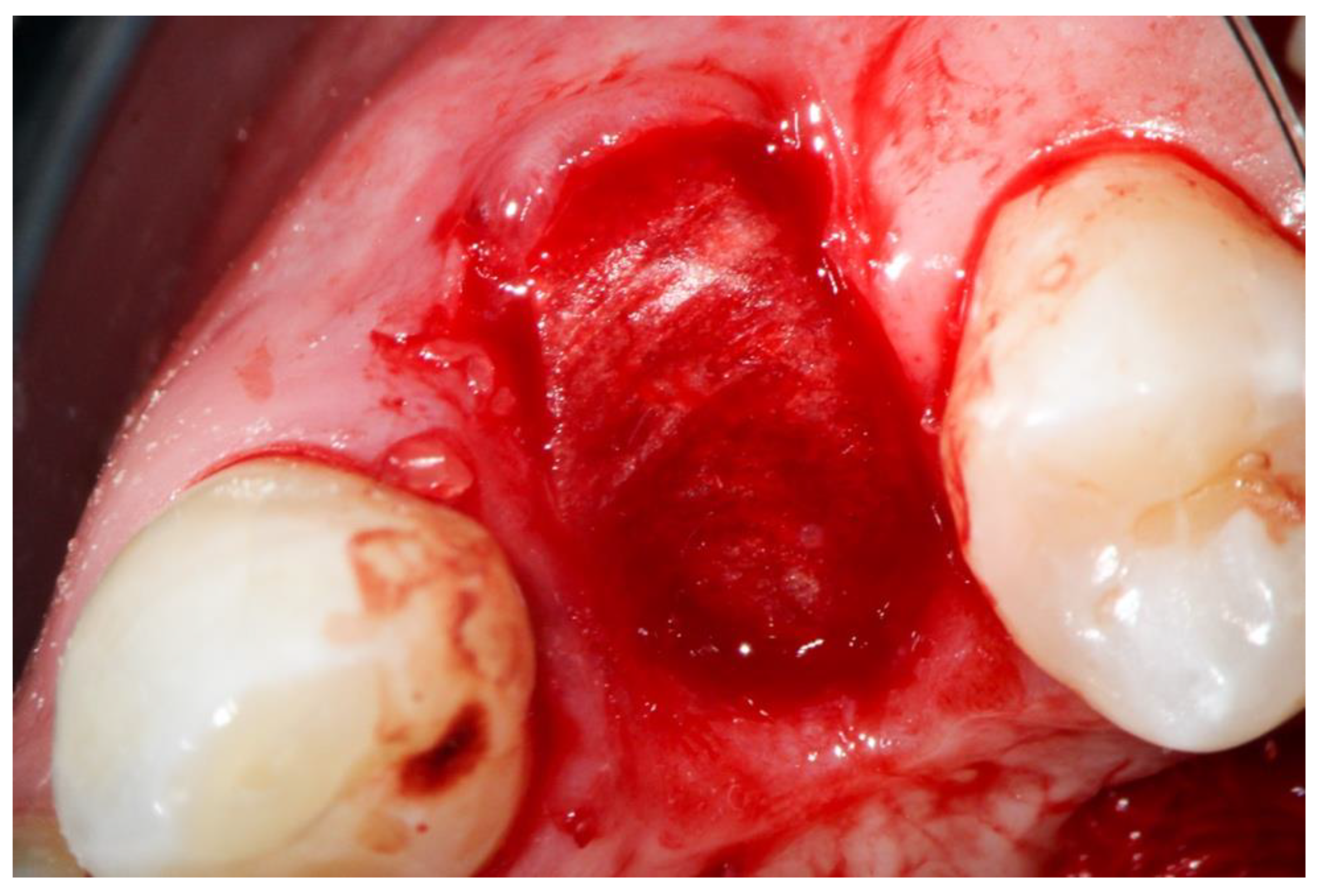 Dentistry 10 00029 g005