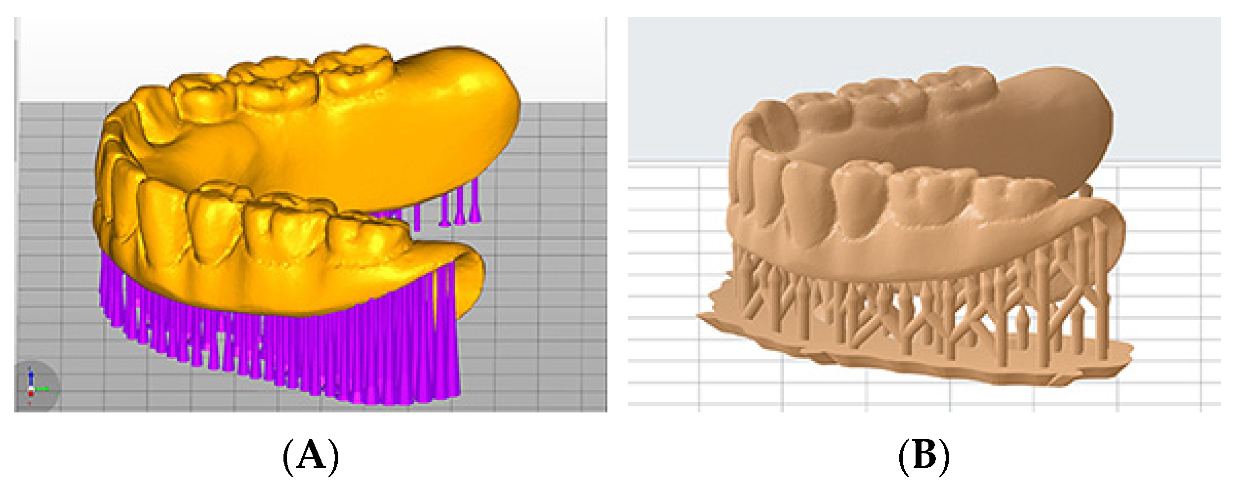 Dentistry 10 00035 g001 550