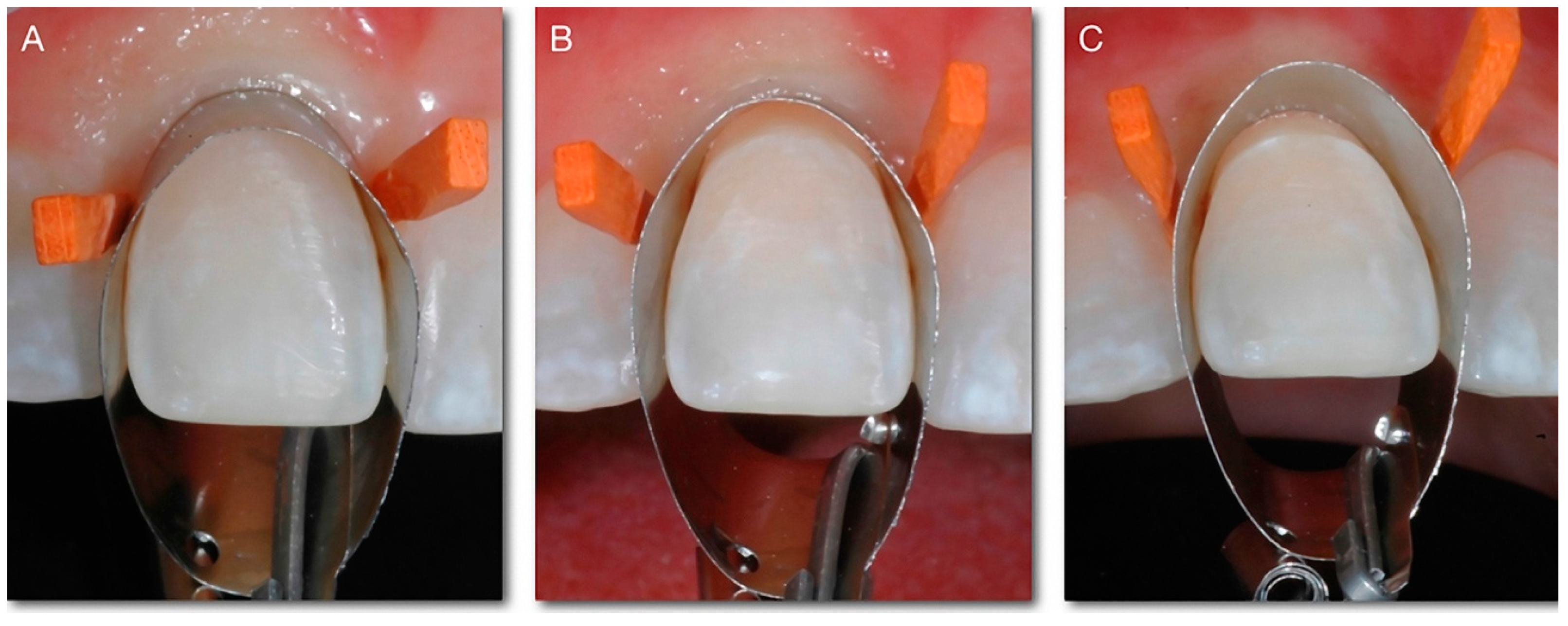 Dentistry 10 00037 g001 550