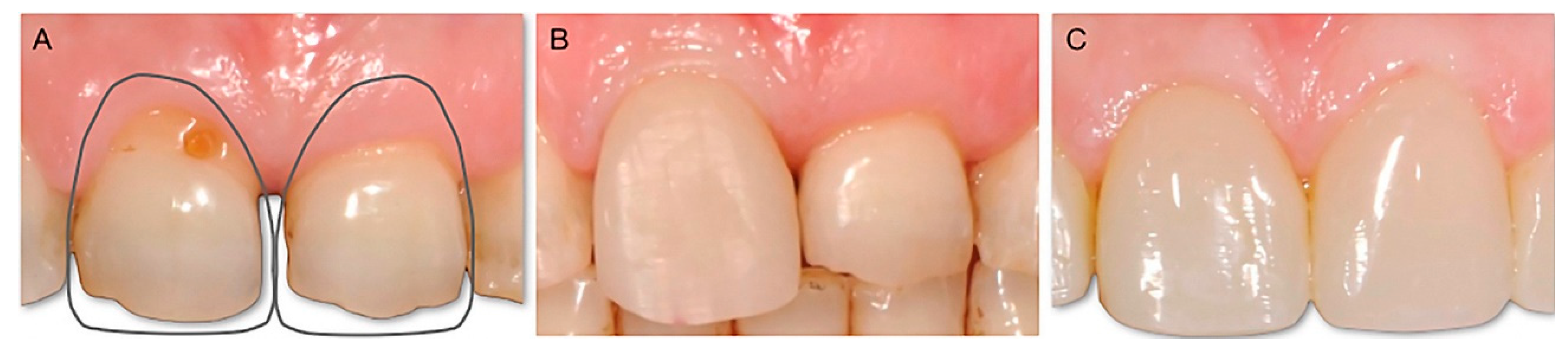 Dentistry 10 00037 g003 550