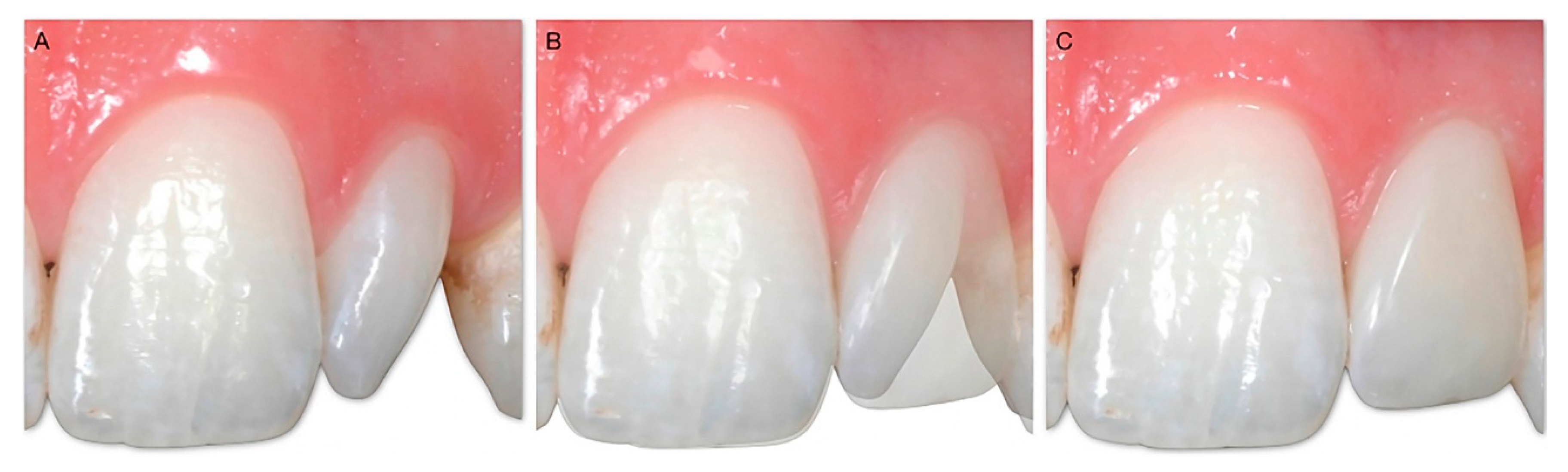 Dentistry 10 00037 g004 550