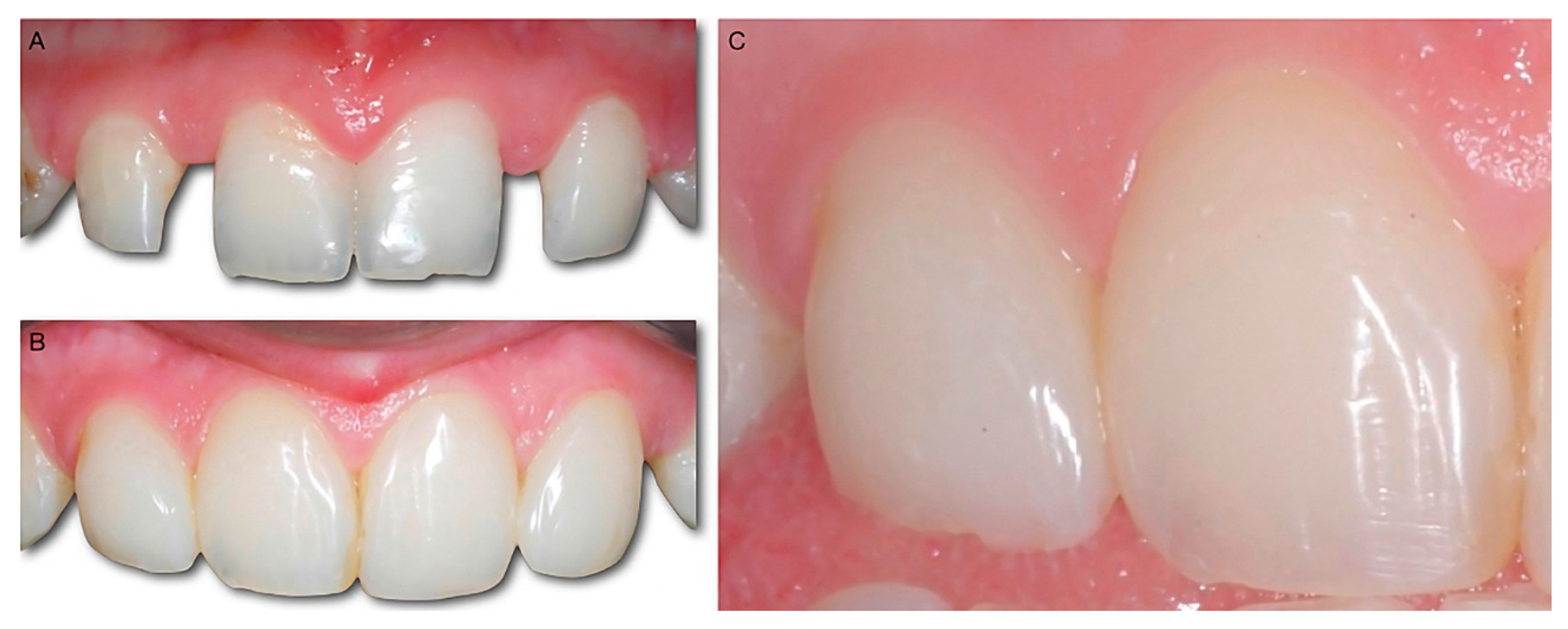 Dentistry 10 00037 g006 550