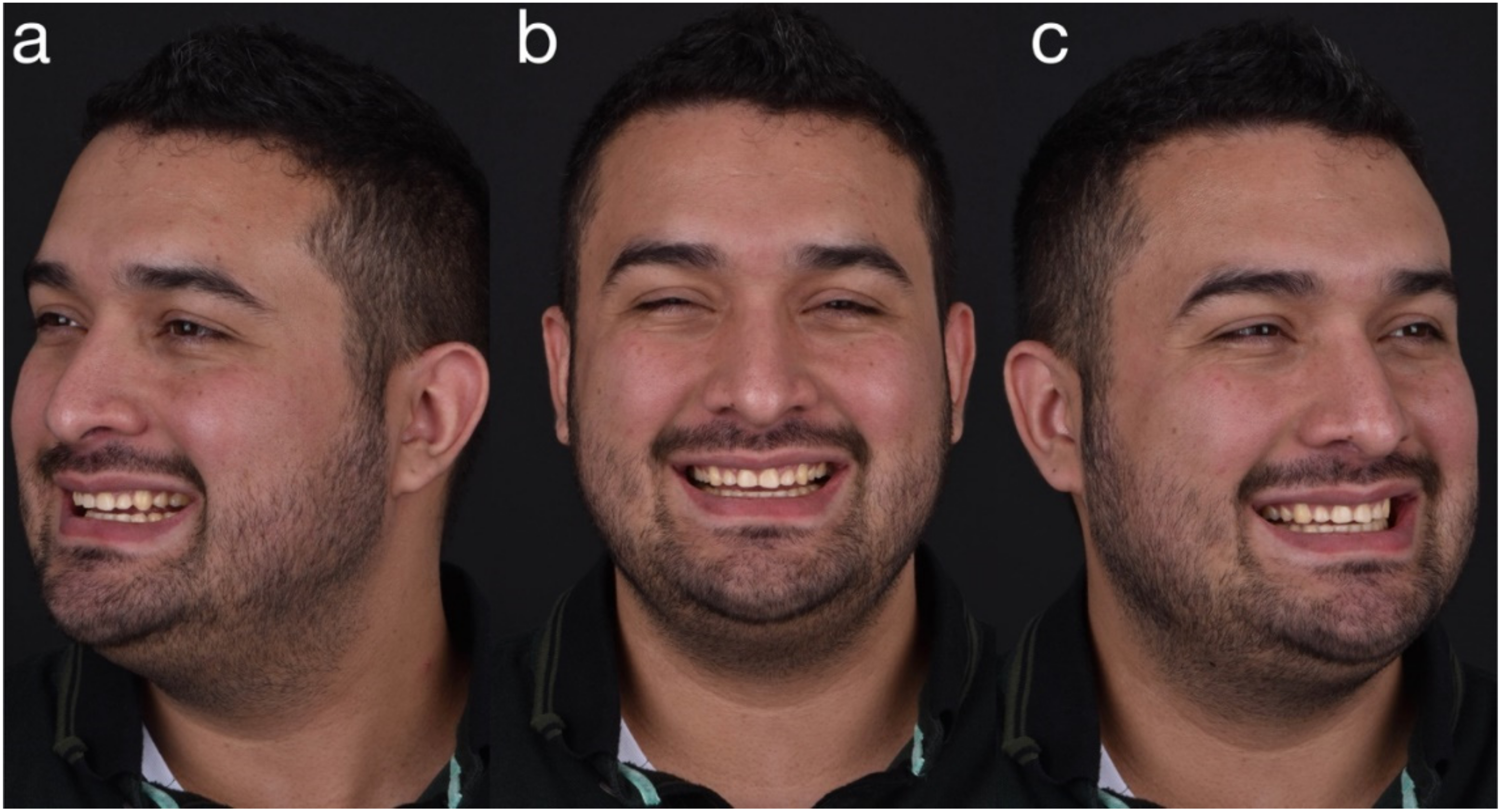 Dentistry 10 00051 g001 550