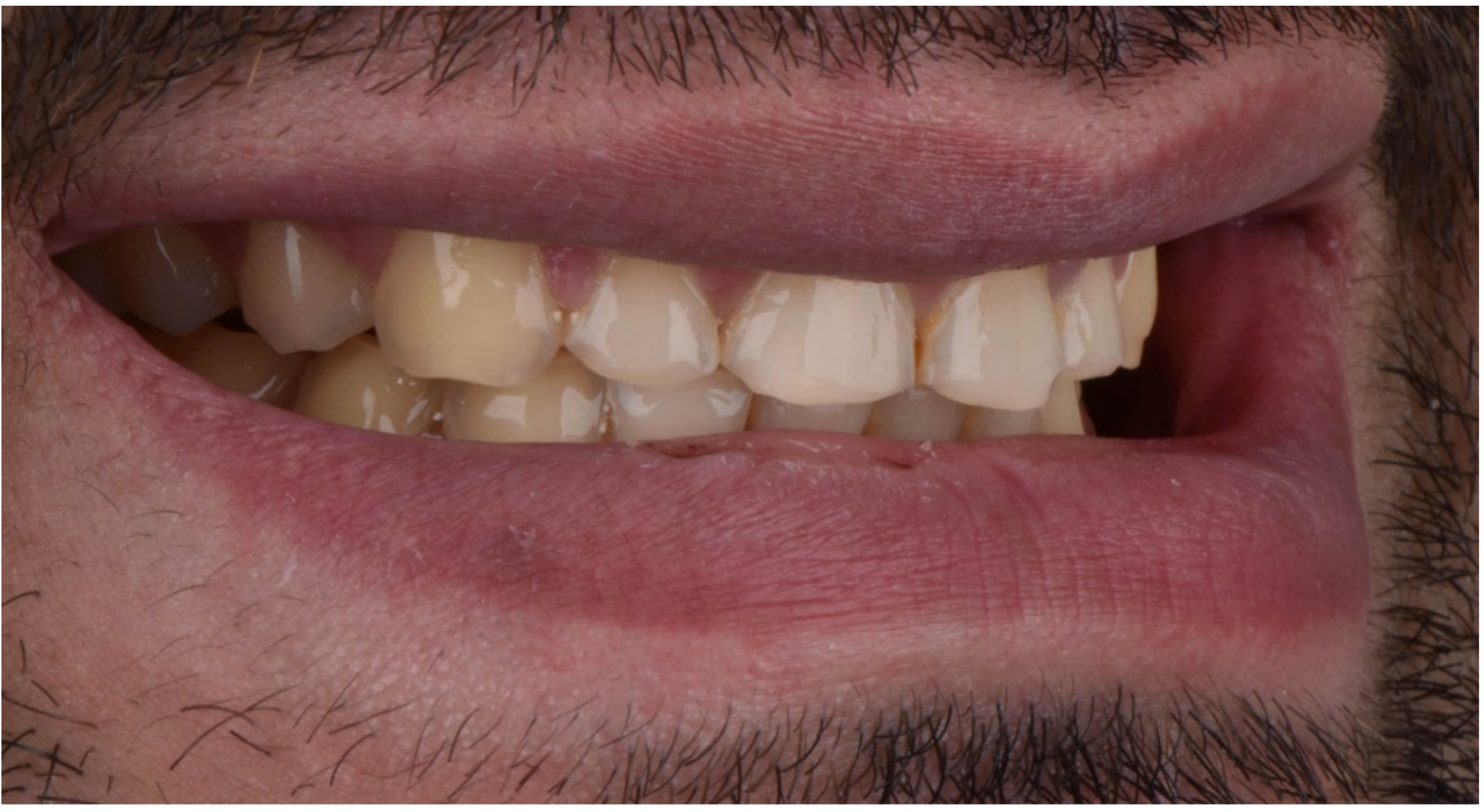 Dentistry 10 00051 g003 550