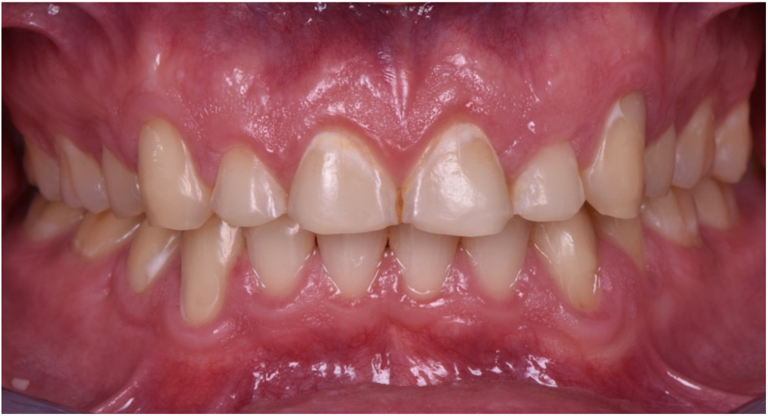 Dentistry 10 00051 g005 550