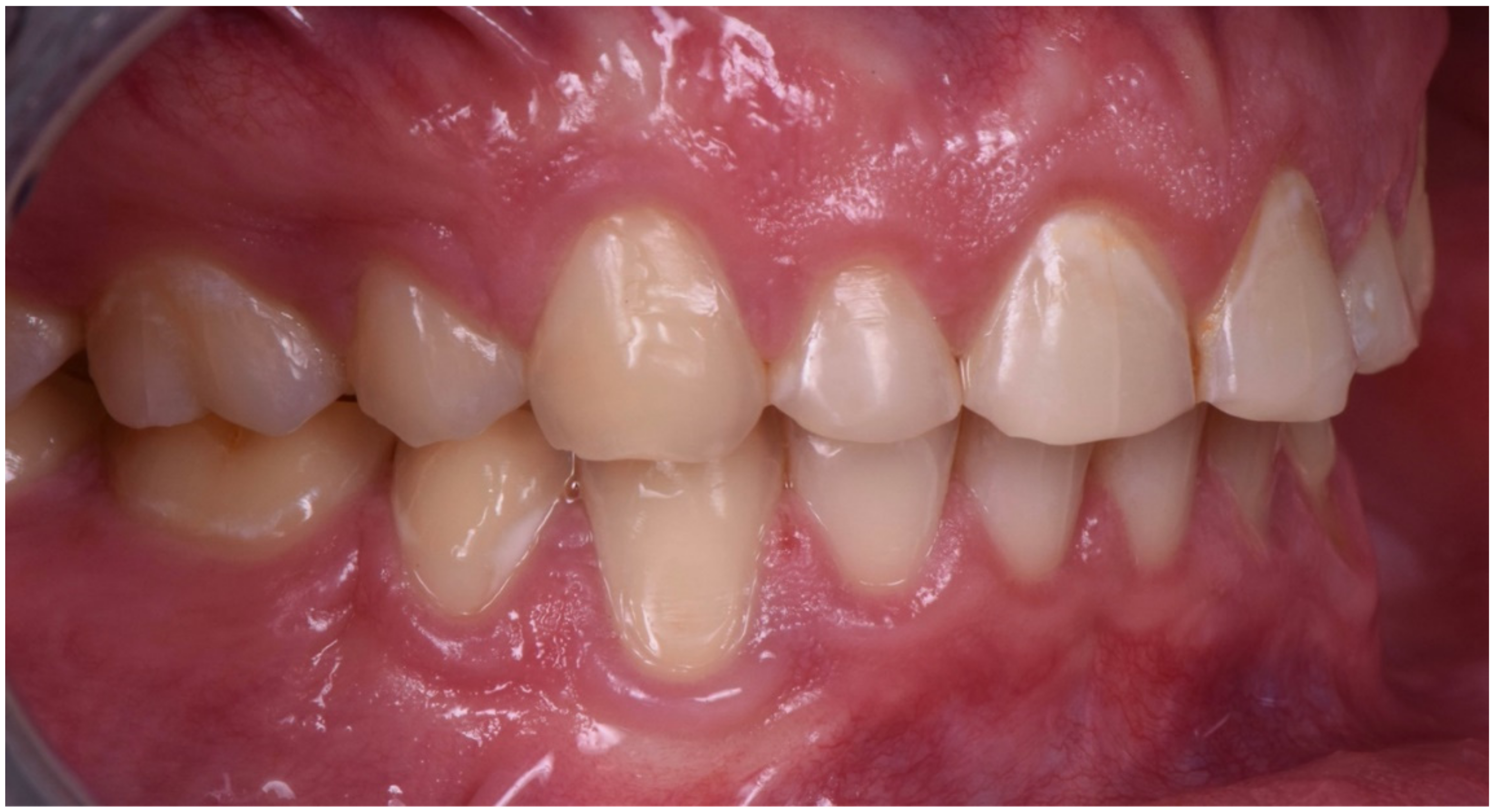 Dentistry 10 00051 g006 550