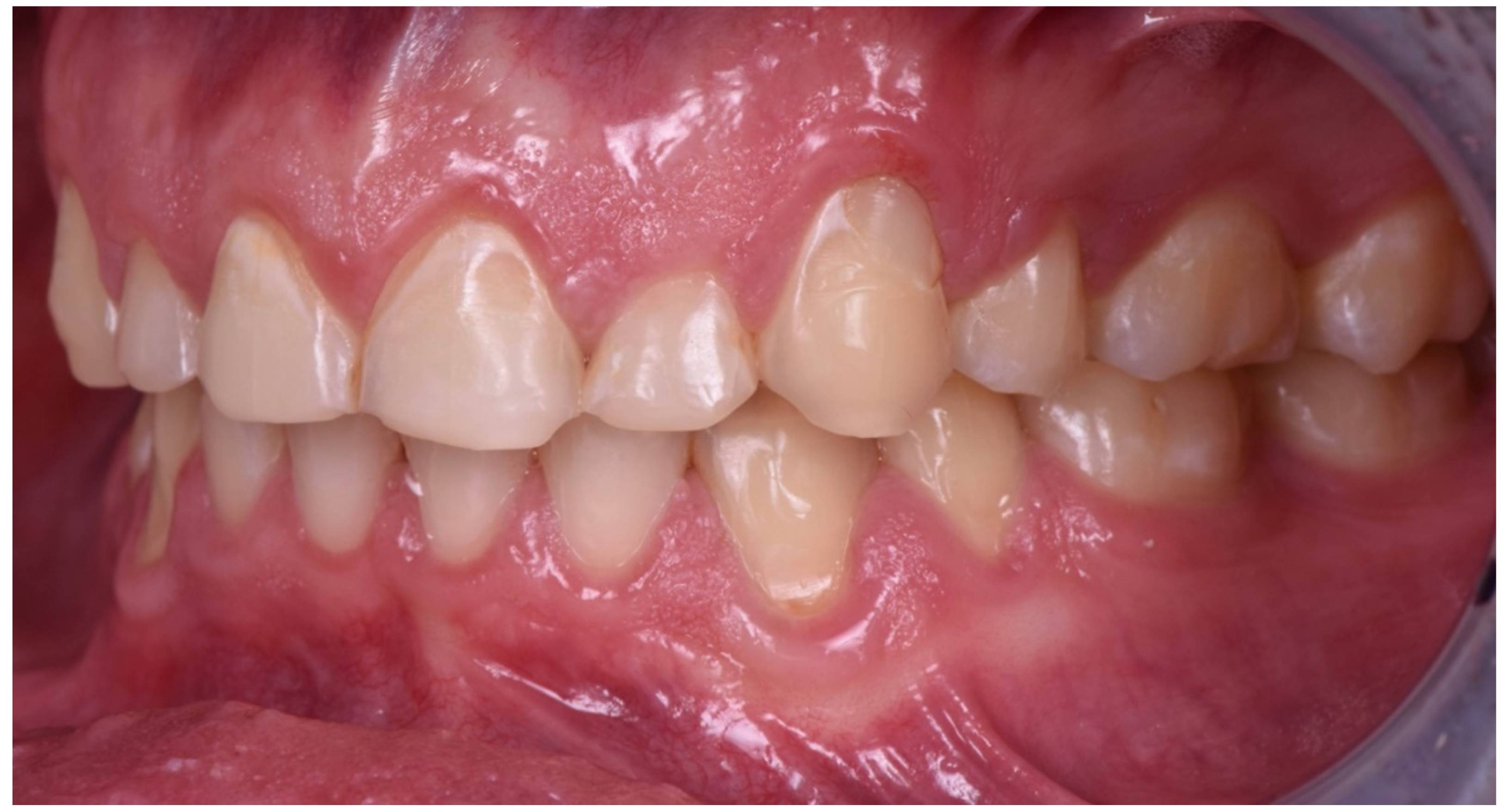 Dentistry 10 00051 g007 550