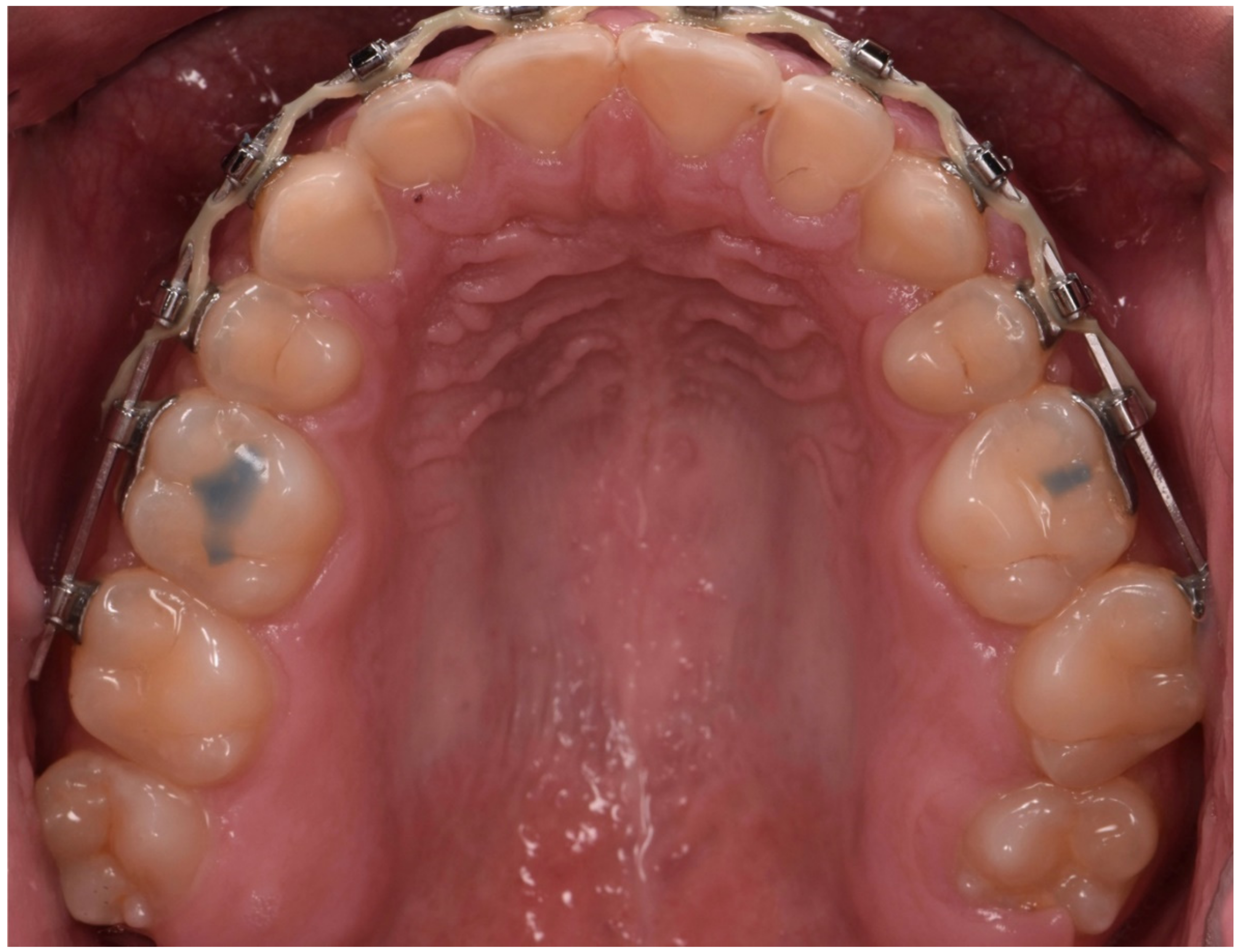 Dentistry 10 00051 g008 550