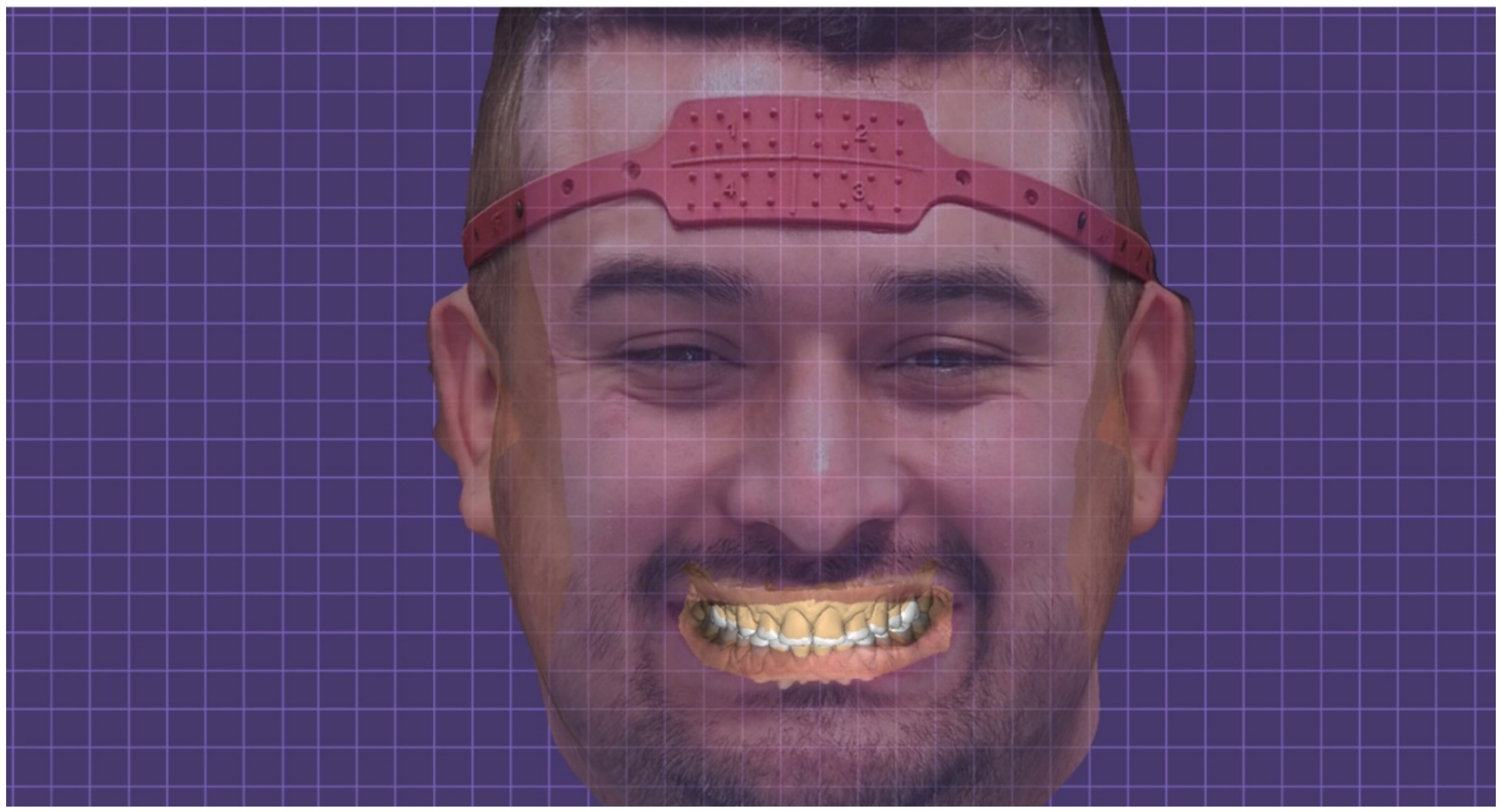 Dentistry 10 00051 g010 550