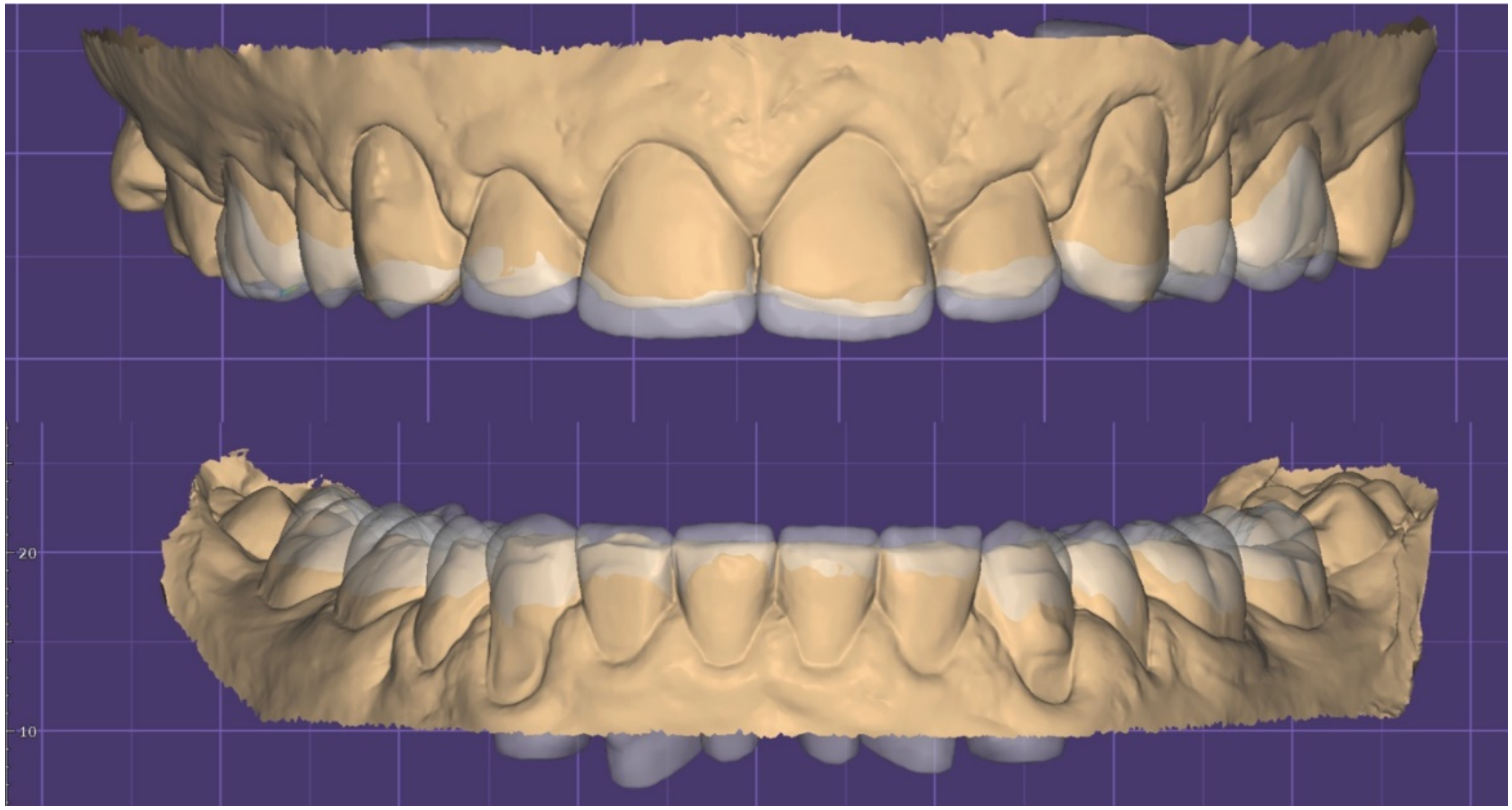 Dentistry 10 00051 g011 550