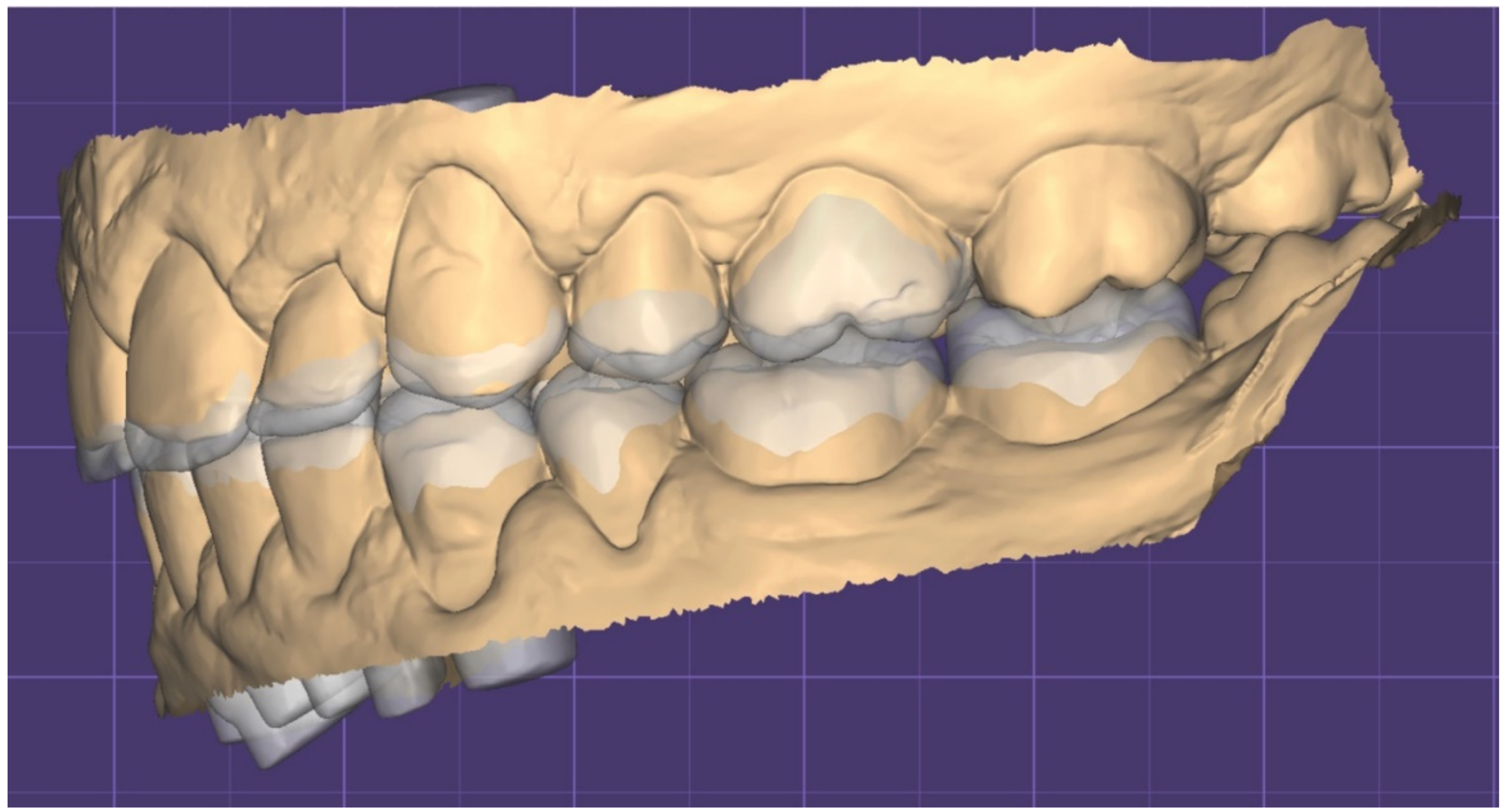 Dentistry 10 00051 g012 550