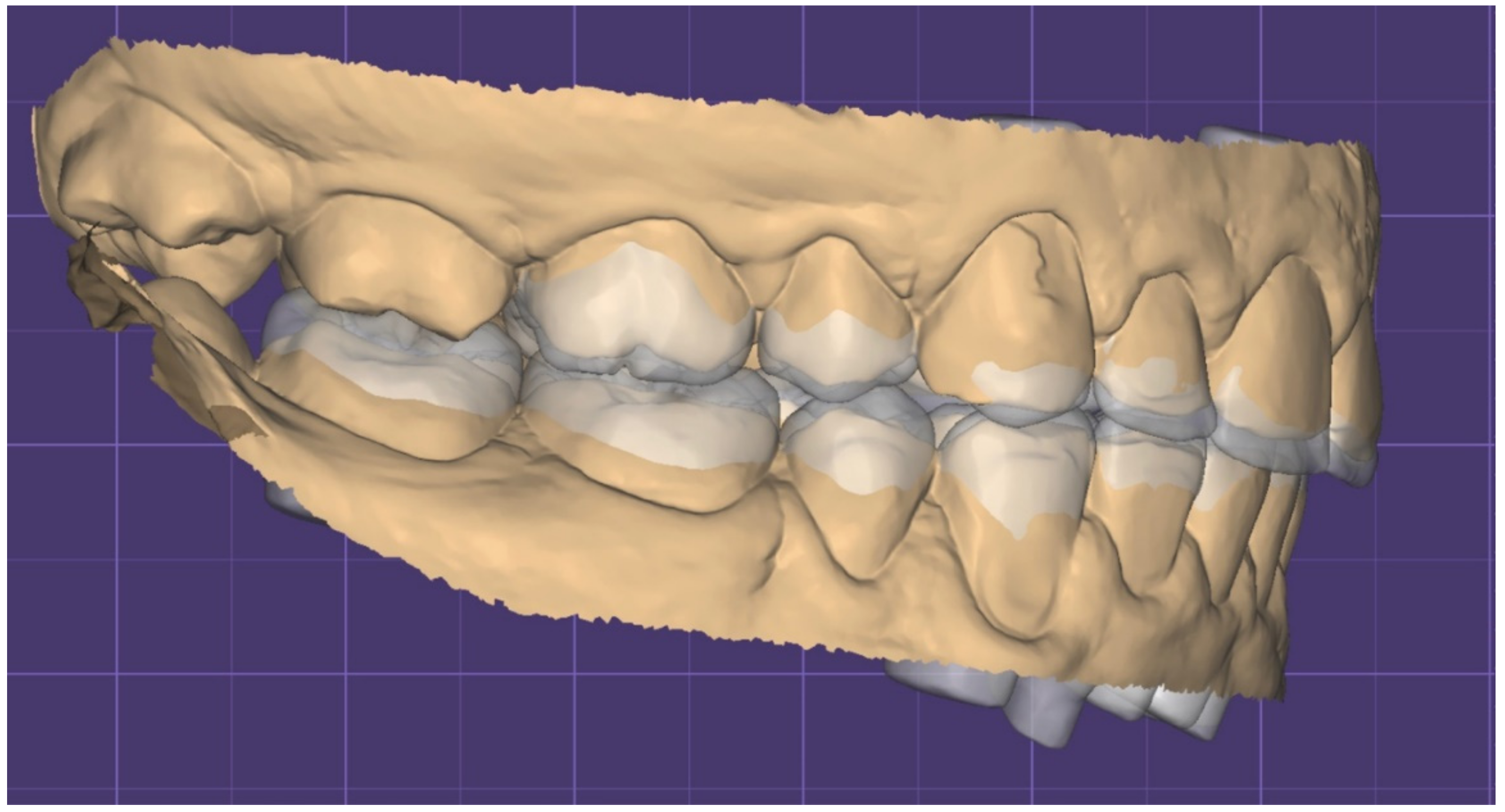 Dentistry 10 00051 g013 550