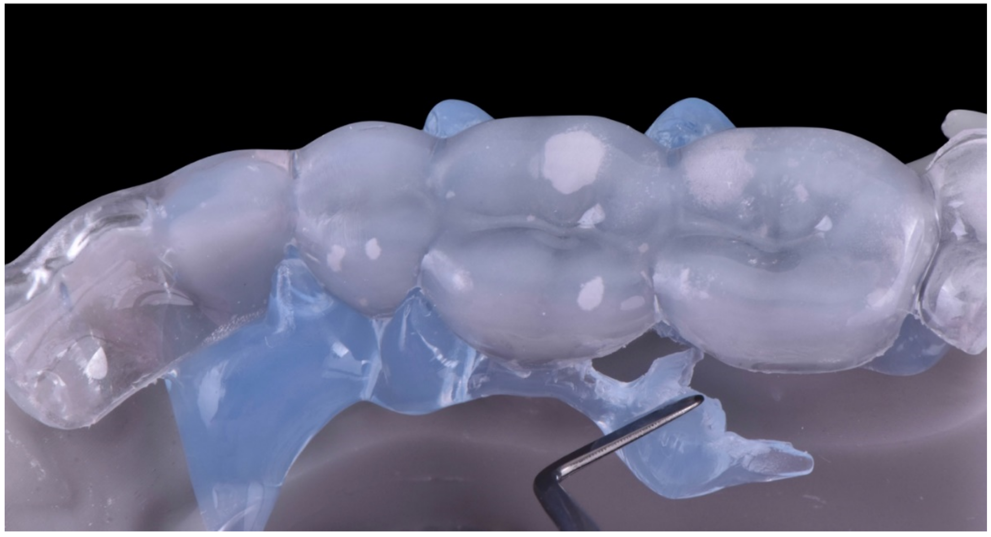 Dentistry 10 00051 g017 550