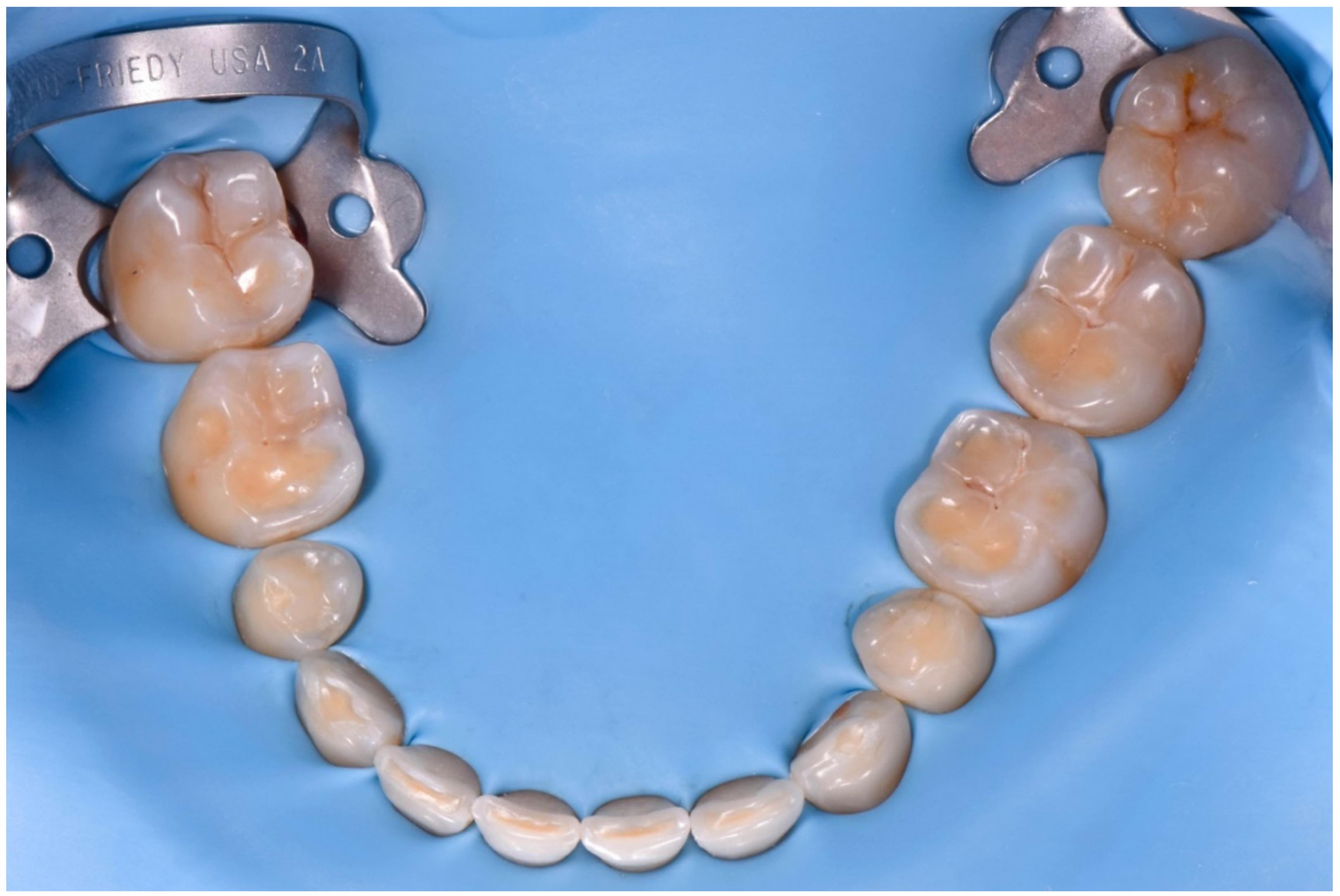 Dentistry 10 00051 g018 550