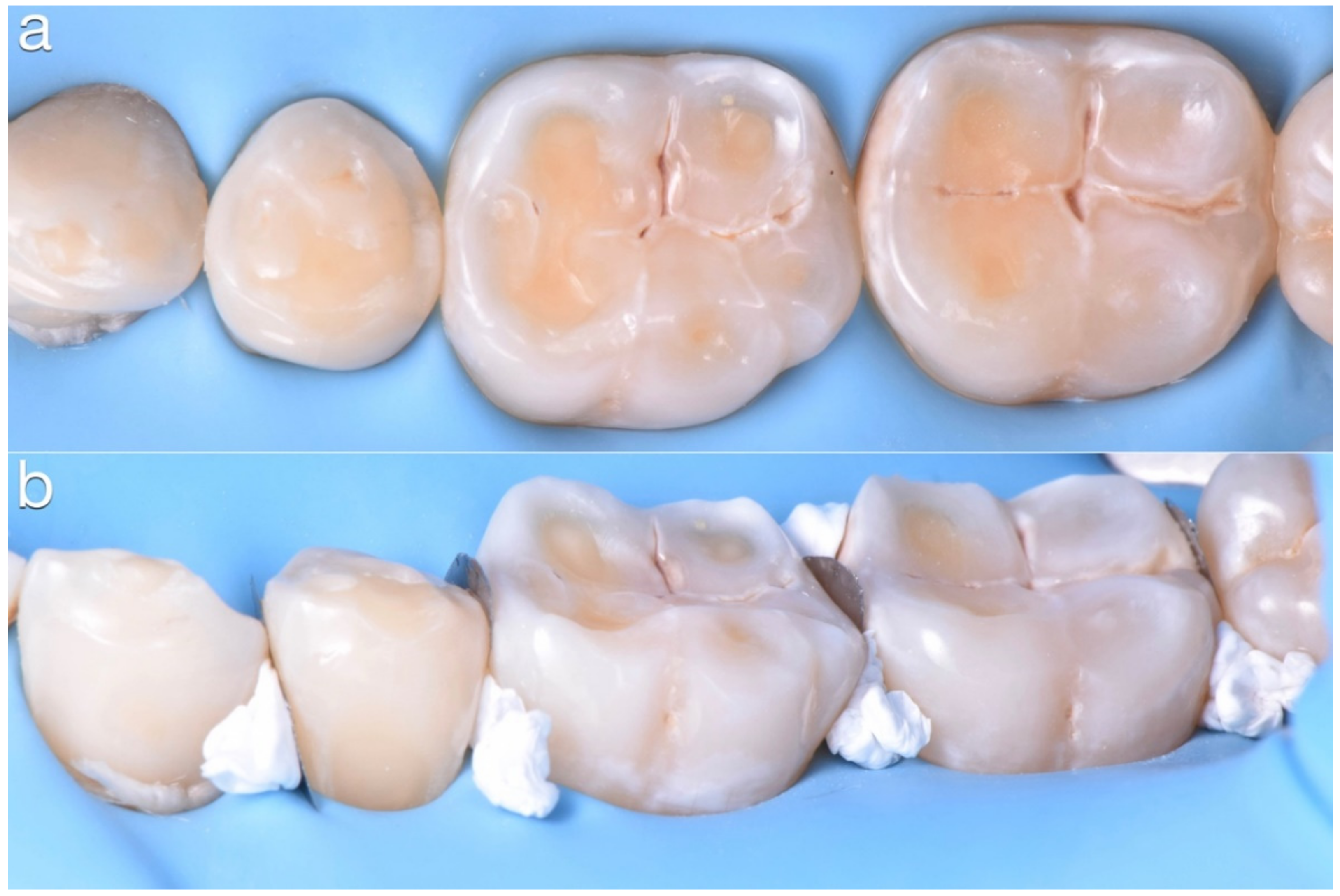 Dentistry 10 00051 g019 550