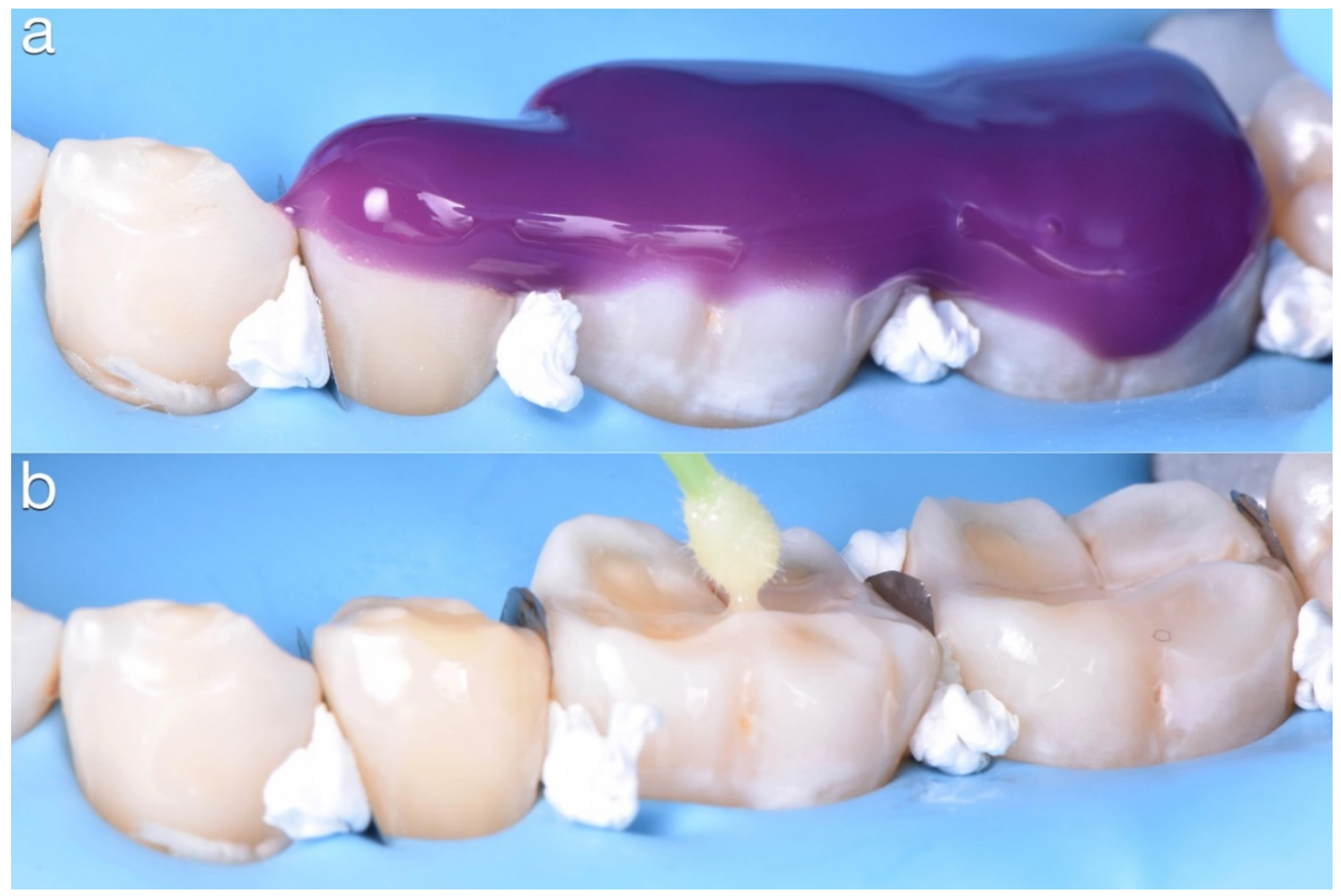 Dentistry 10 00051 g020 550