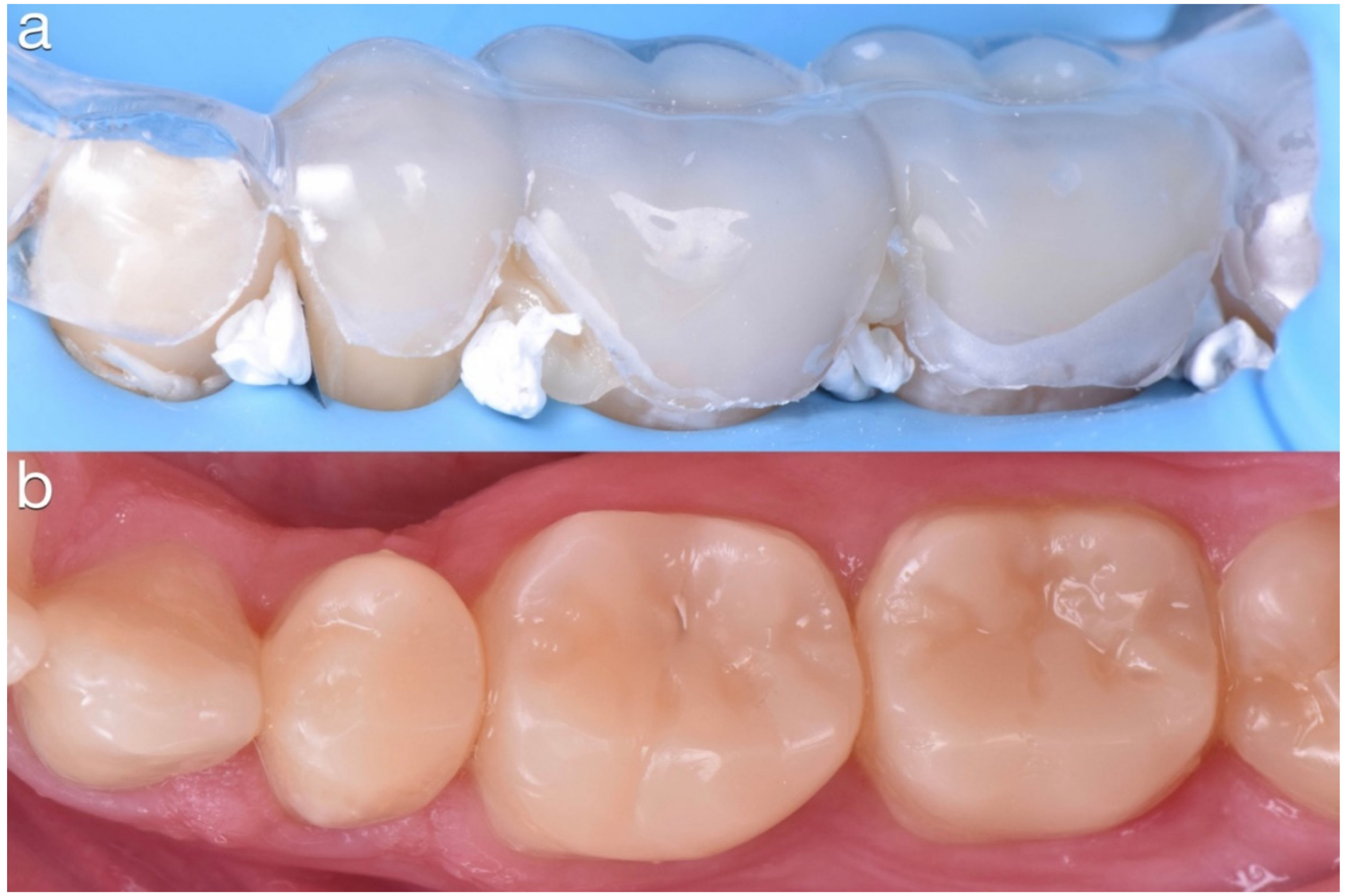 Dentistry 10 00051 g021 550